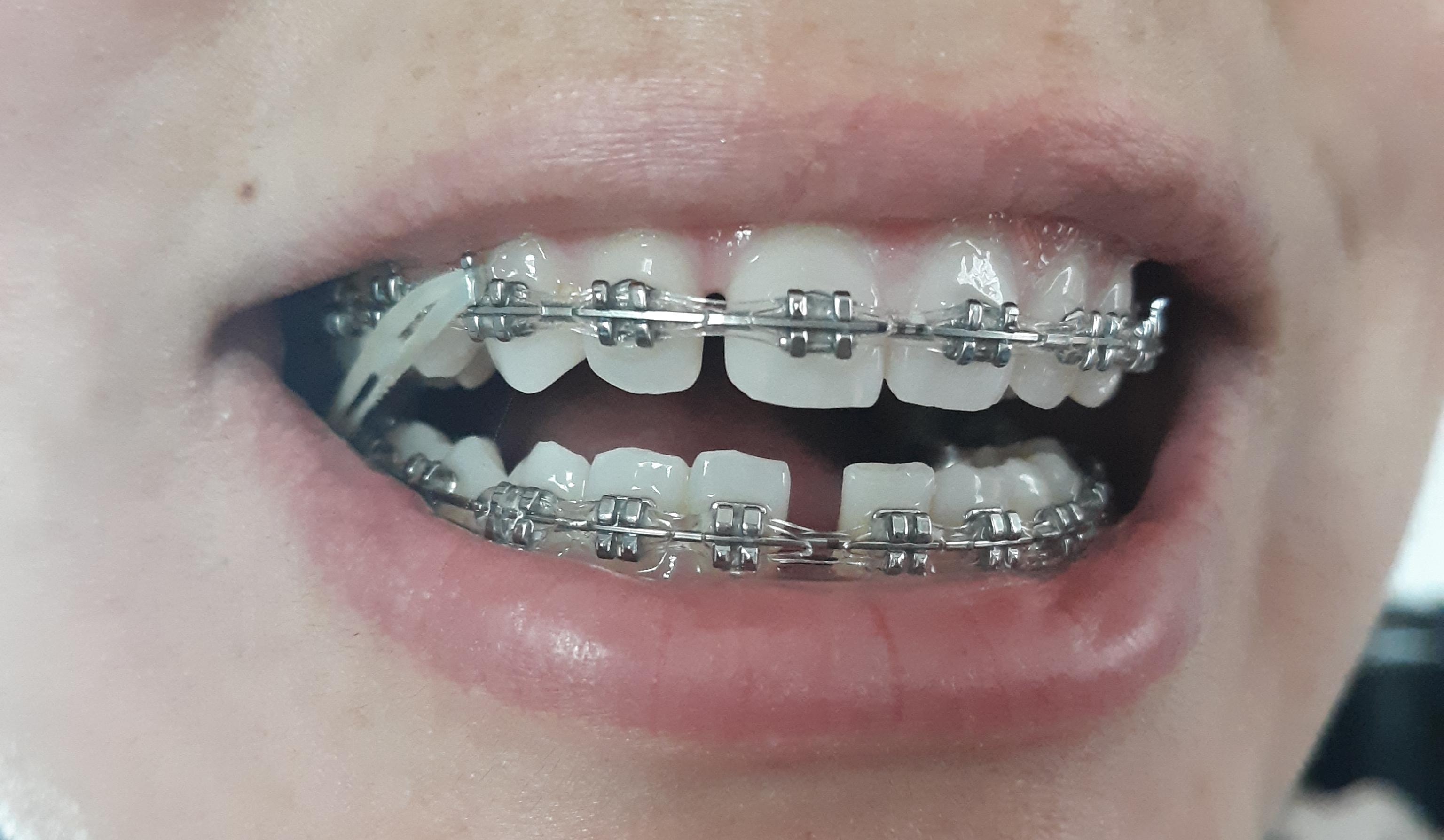 I got a chain today. I chose clear, so I hope you can see it. I didn't