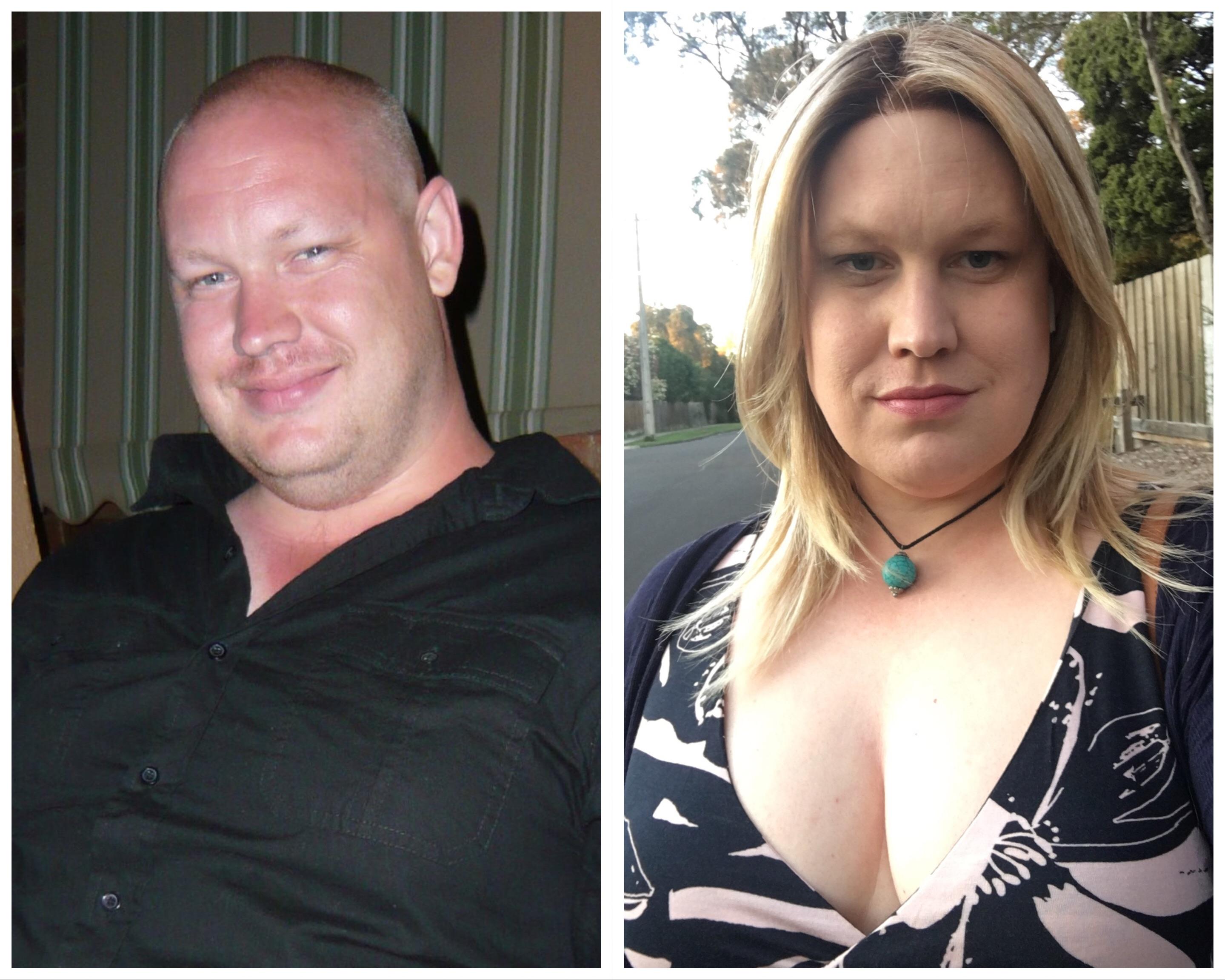 36 MTF, 10 months HRT. Never been happier ) transtimelines