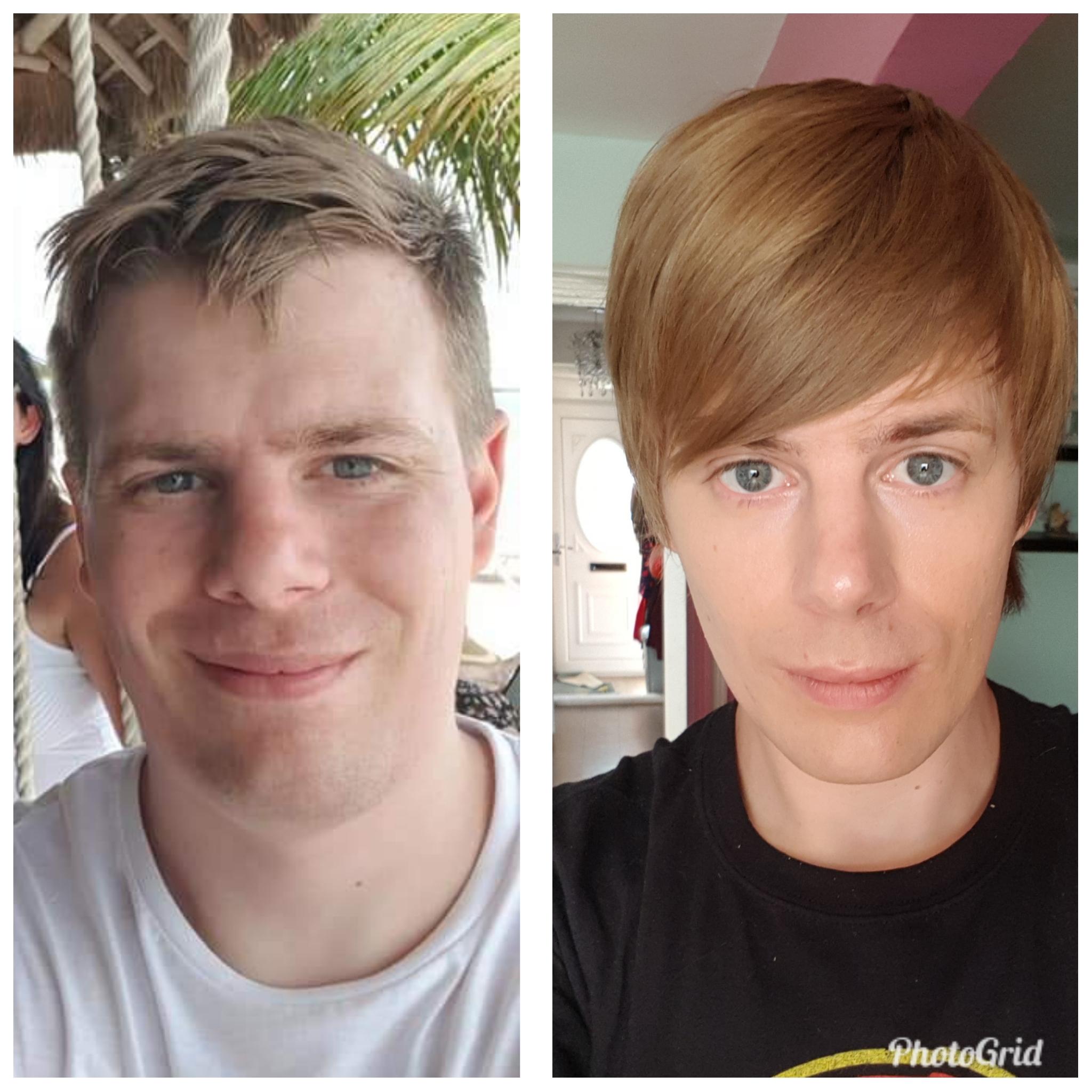 Hrt And Facial Hair Growth at Reginald McKeon blog