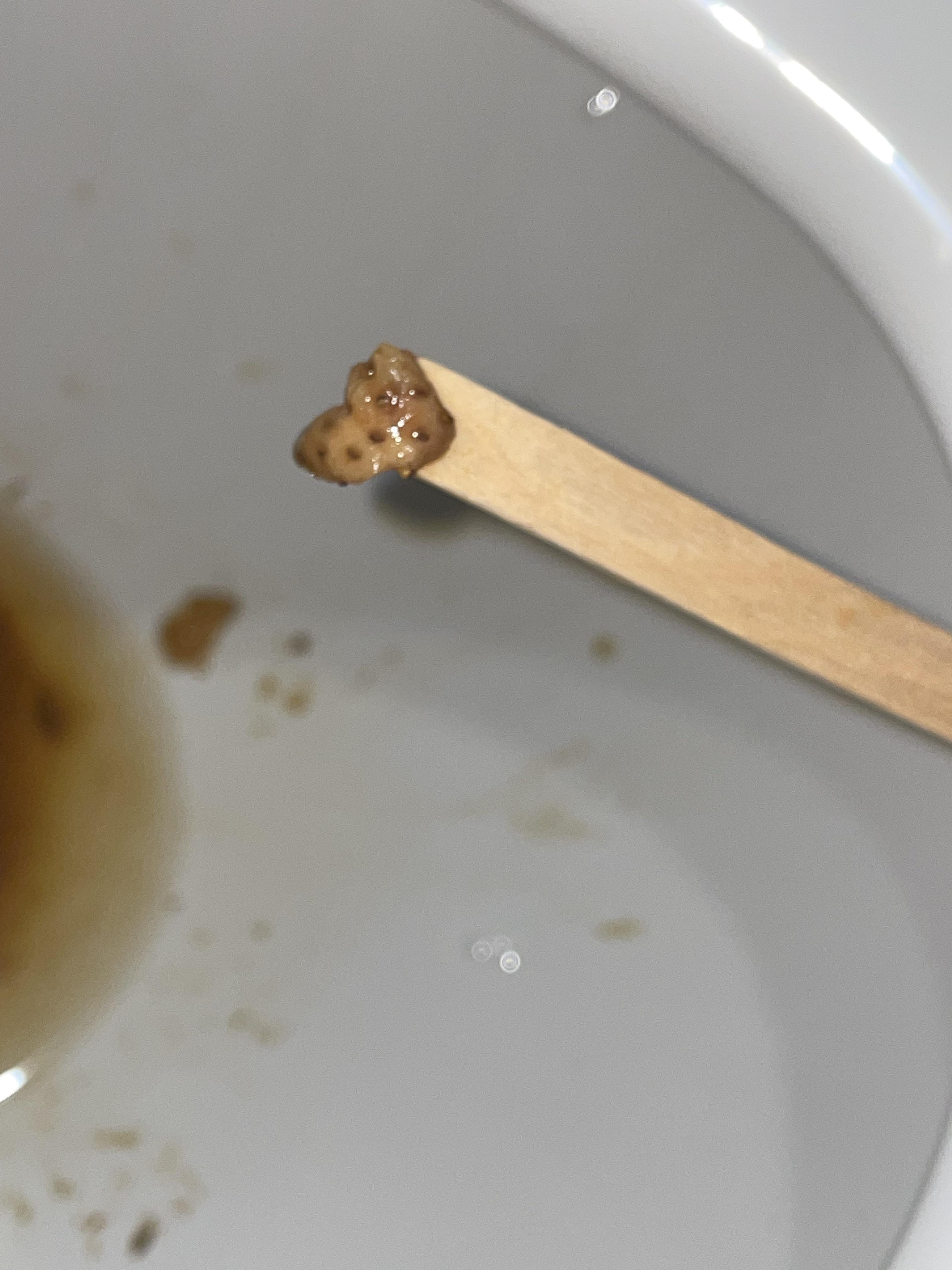 Why did i poop out a strawberry r/poop