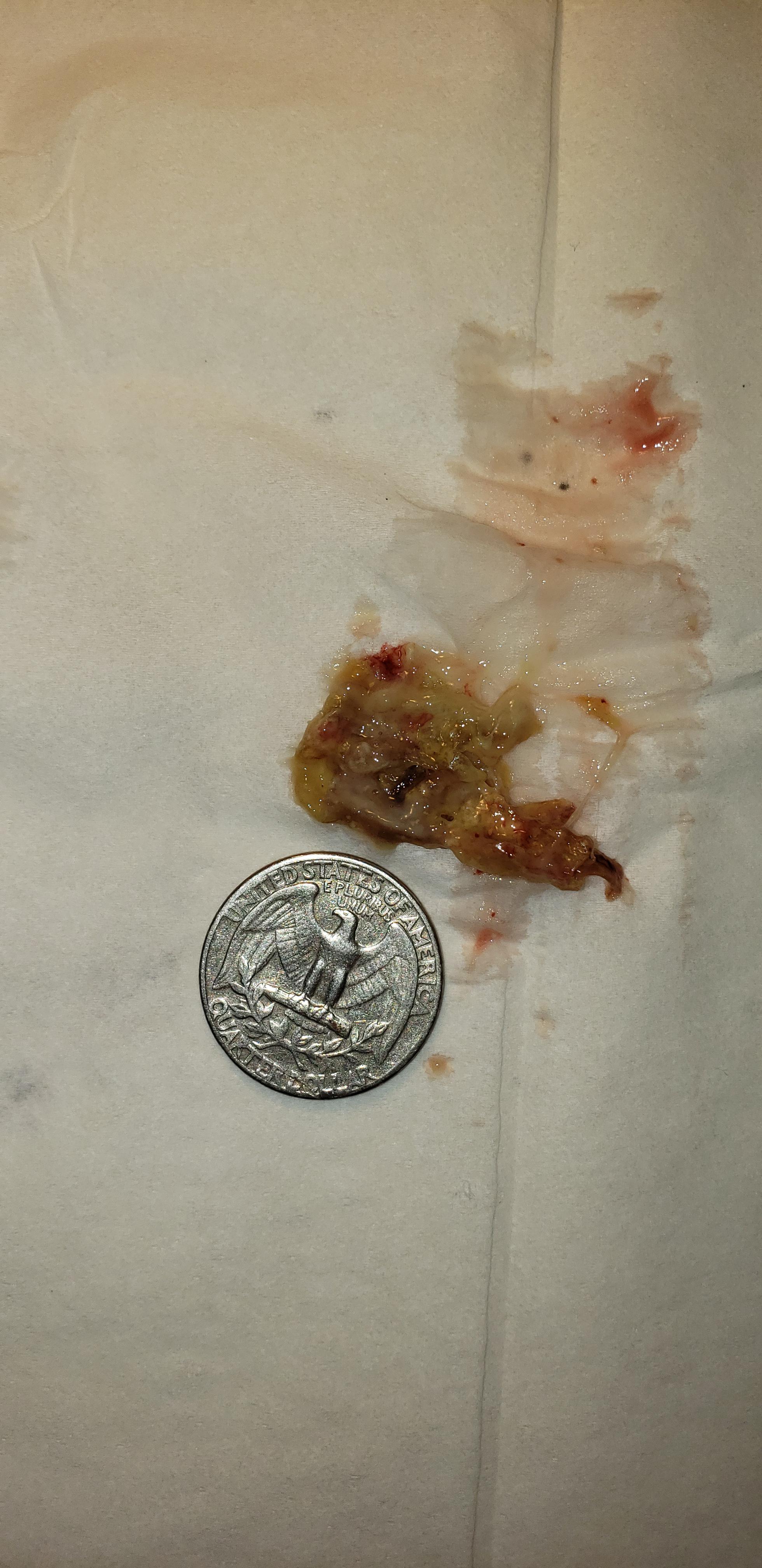 By far the most satisfying booger I blown out since being here