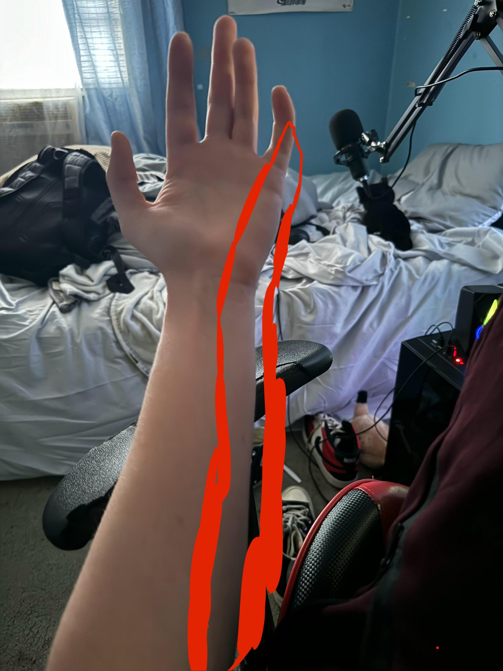 The circled part of my fretting hand hurts so bad sometimes when