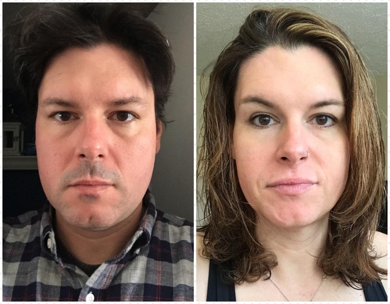 43yo 25mths HRT Facial Changes r/transtimelines