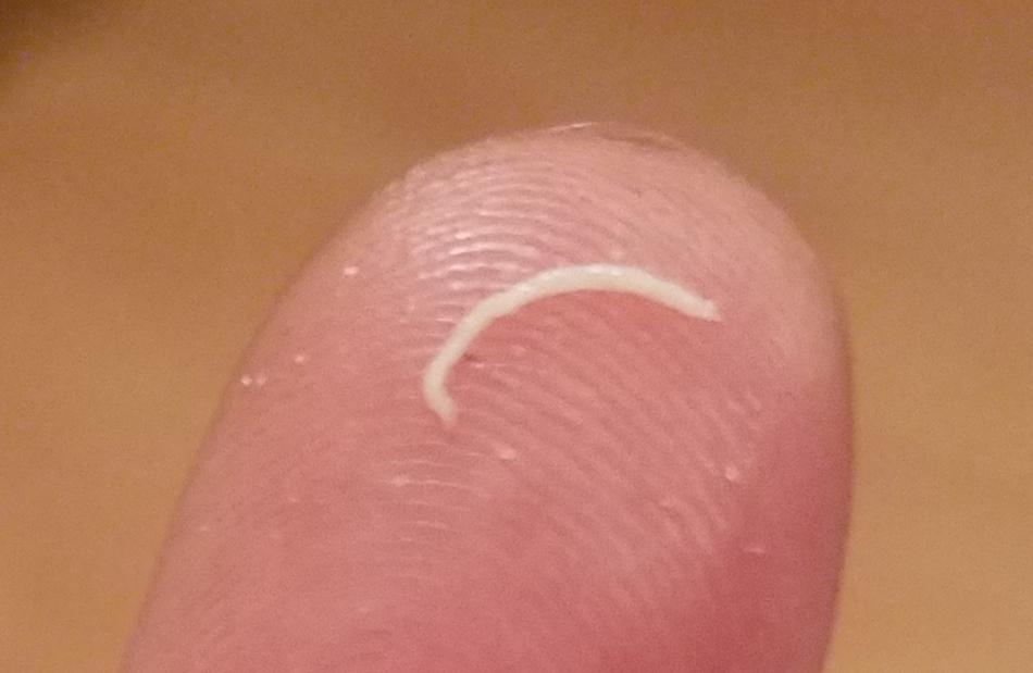 Felt a little lump in my armpit. Squeezed out some sebaceous goop! r/popping