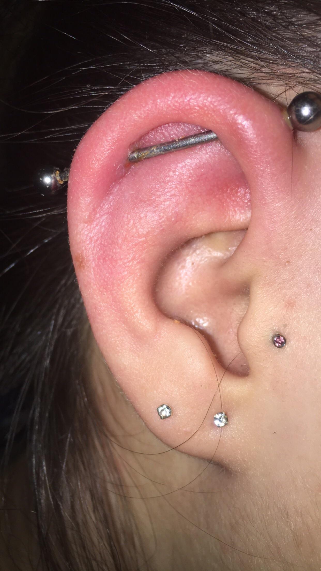 Lumps on industrial! I got this pierced a week ago and it’s really