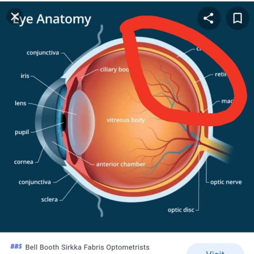 constant pain in my eyes(in the red circle) for the last 4days r