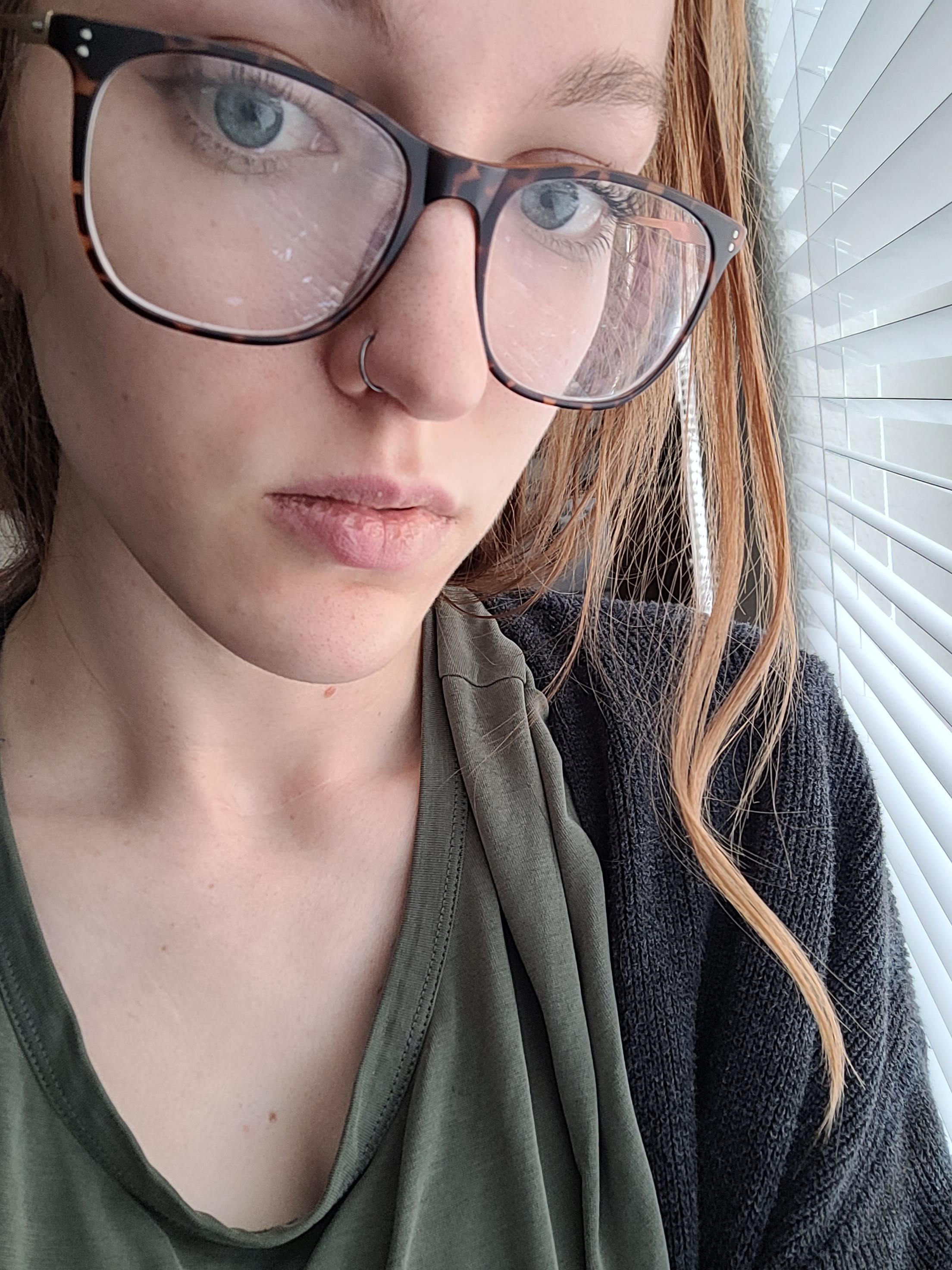 [Skin Concerns] Neverending, yearslong, dry, tough, peeling skin on