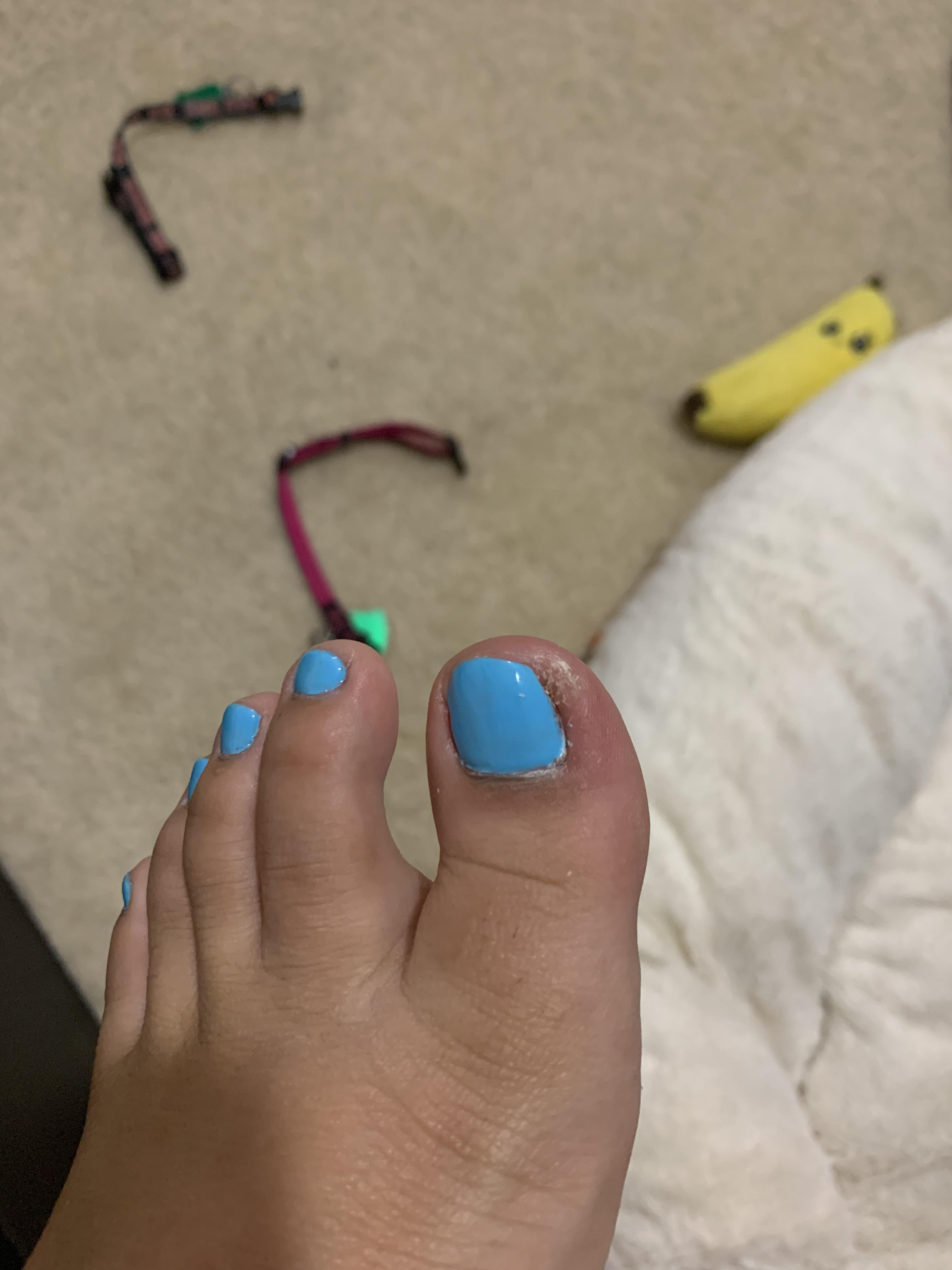 Ingrown toenail that is constantly growing back. Should I go see a