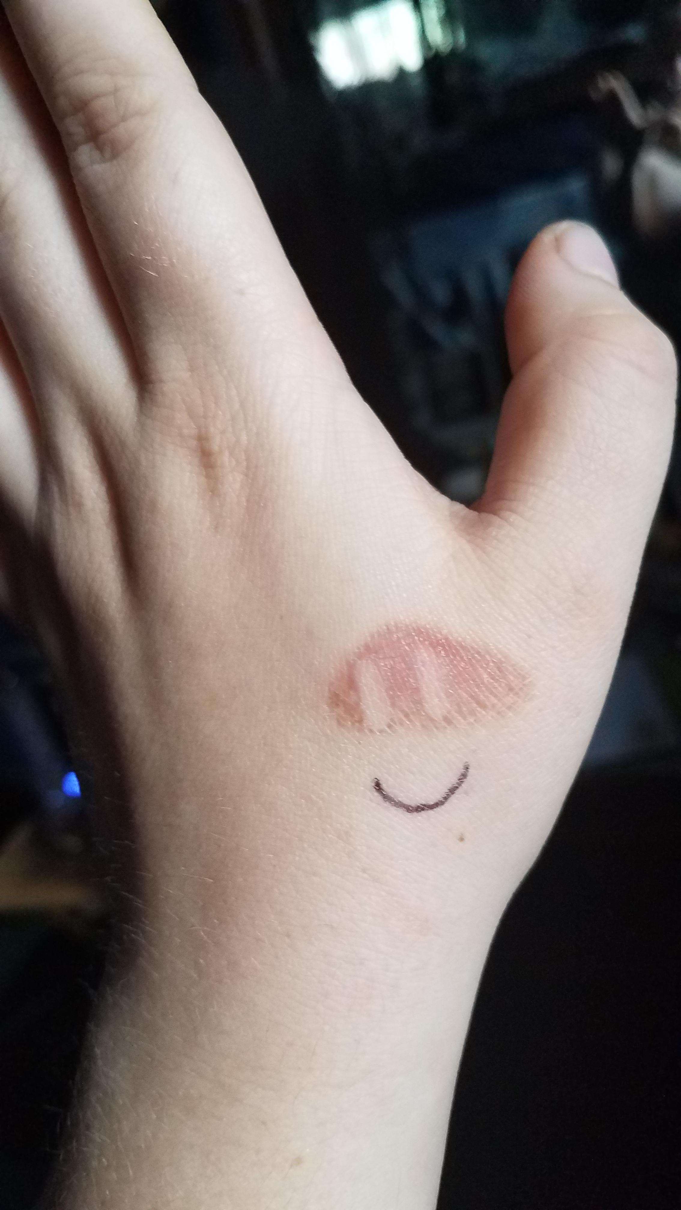 Had a bad day yesterday and burned myself on the toaster oven to top it all off. This tiny line