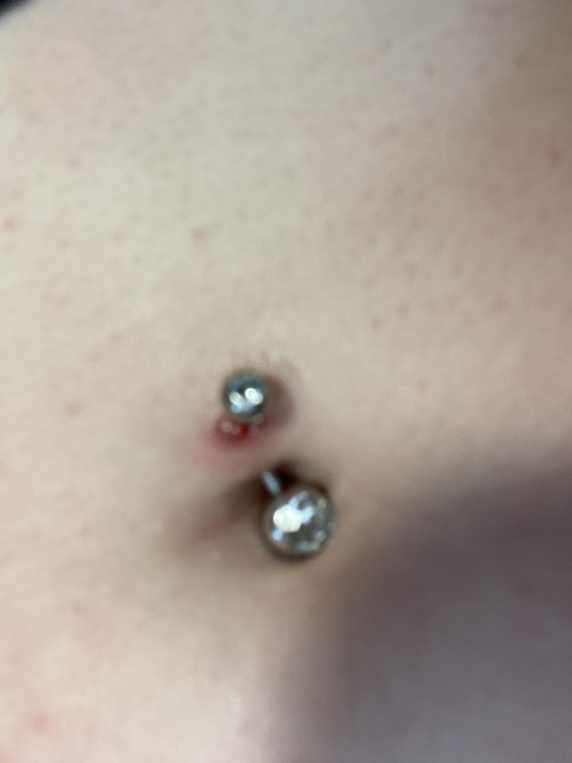 How do I fix this? It’s a small red bump and it’s not hard. It almost