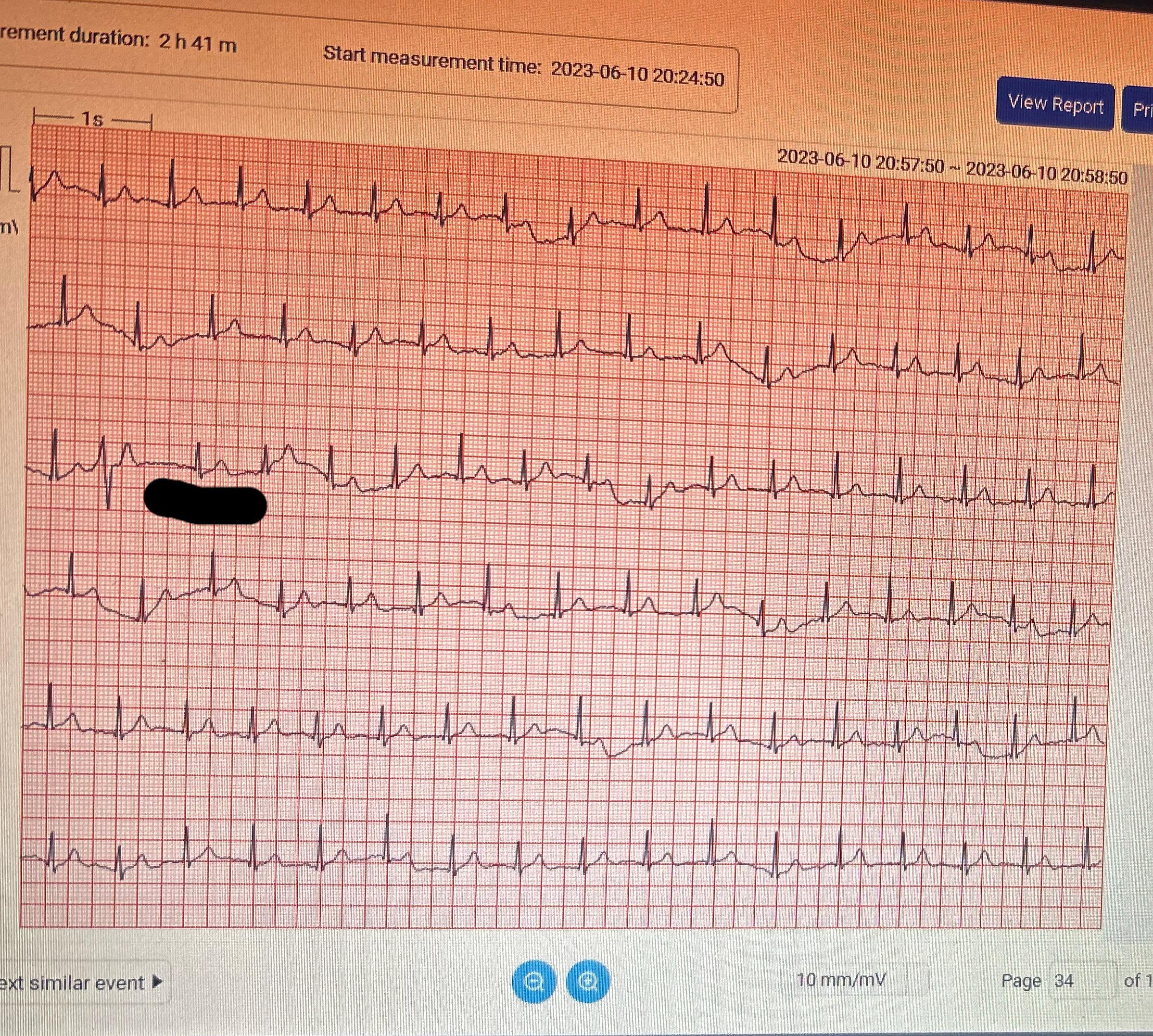 Spoiler alert Define Lil guy 2 r/PVCs