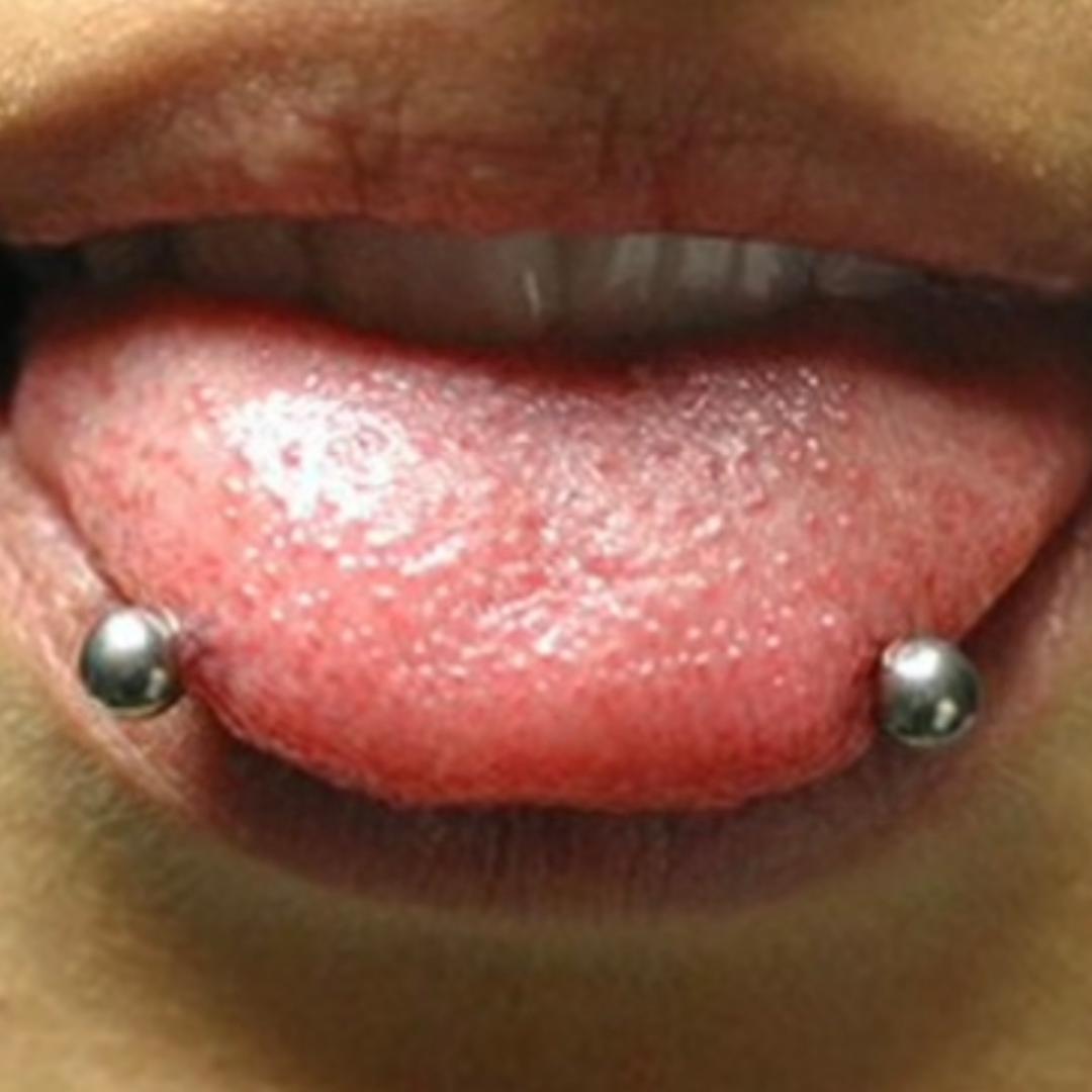 Why is the snake bite piercing so dangerous? r/piercing