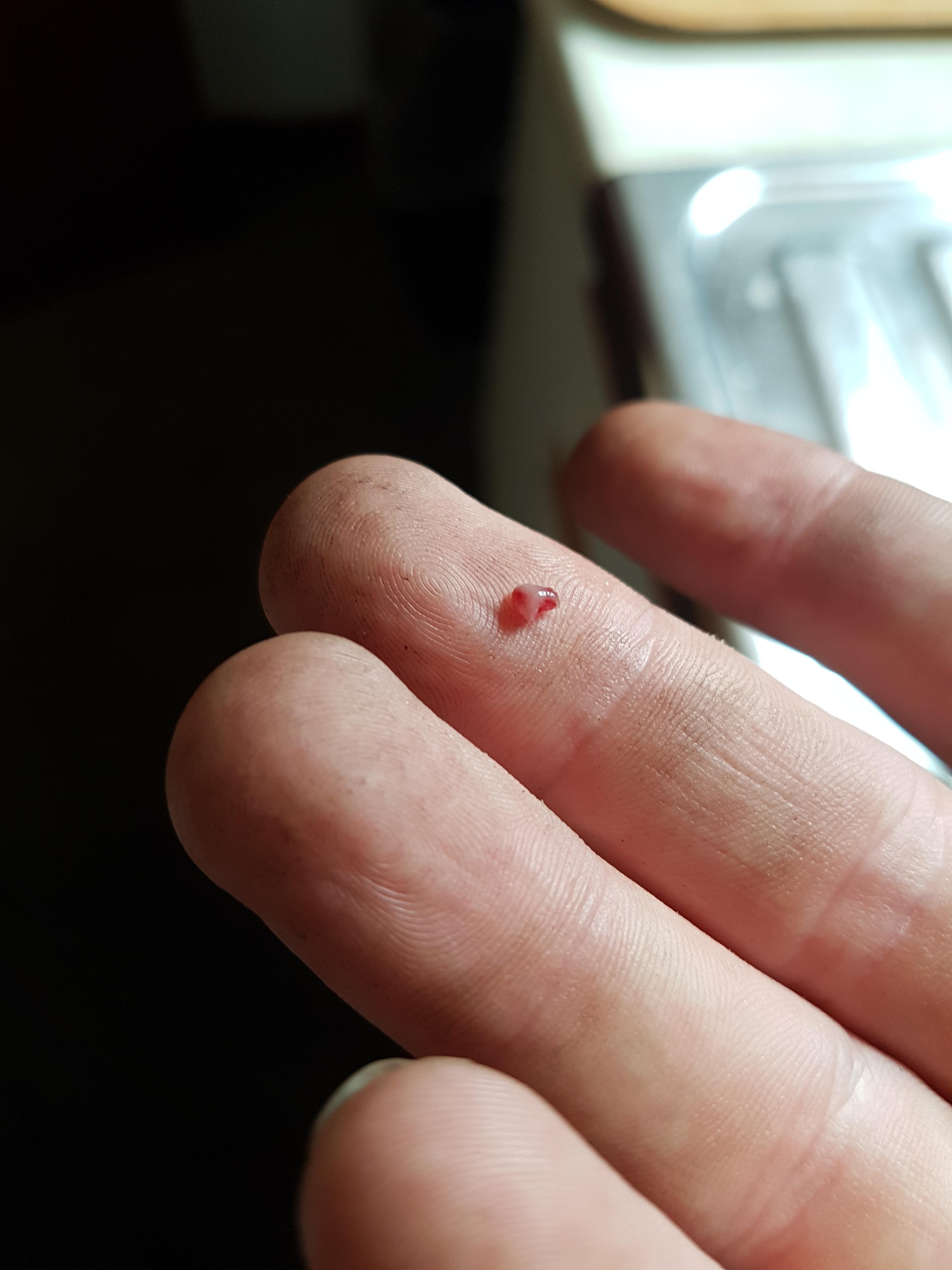 Just bit off my swollen tastebud r/MakeMeSuffer