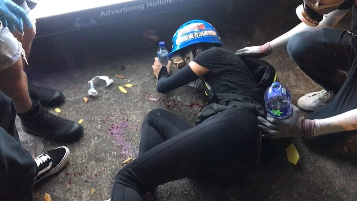 A female protestor was head shot and shot in the eye by