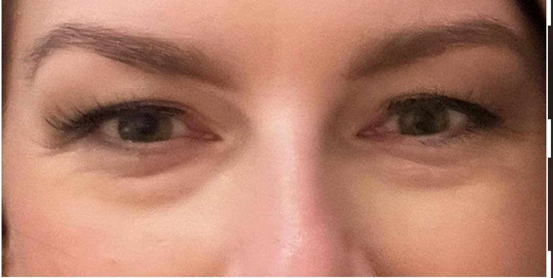 [Product Request] eye bags I hate them so much. r/SkincareAddiction