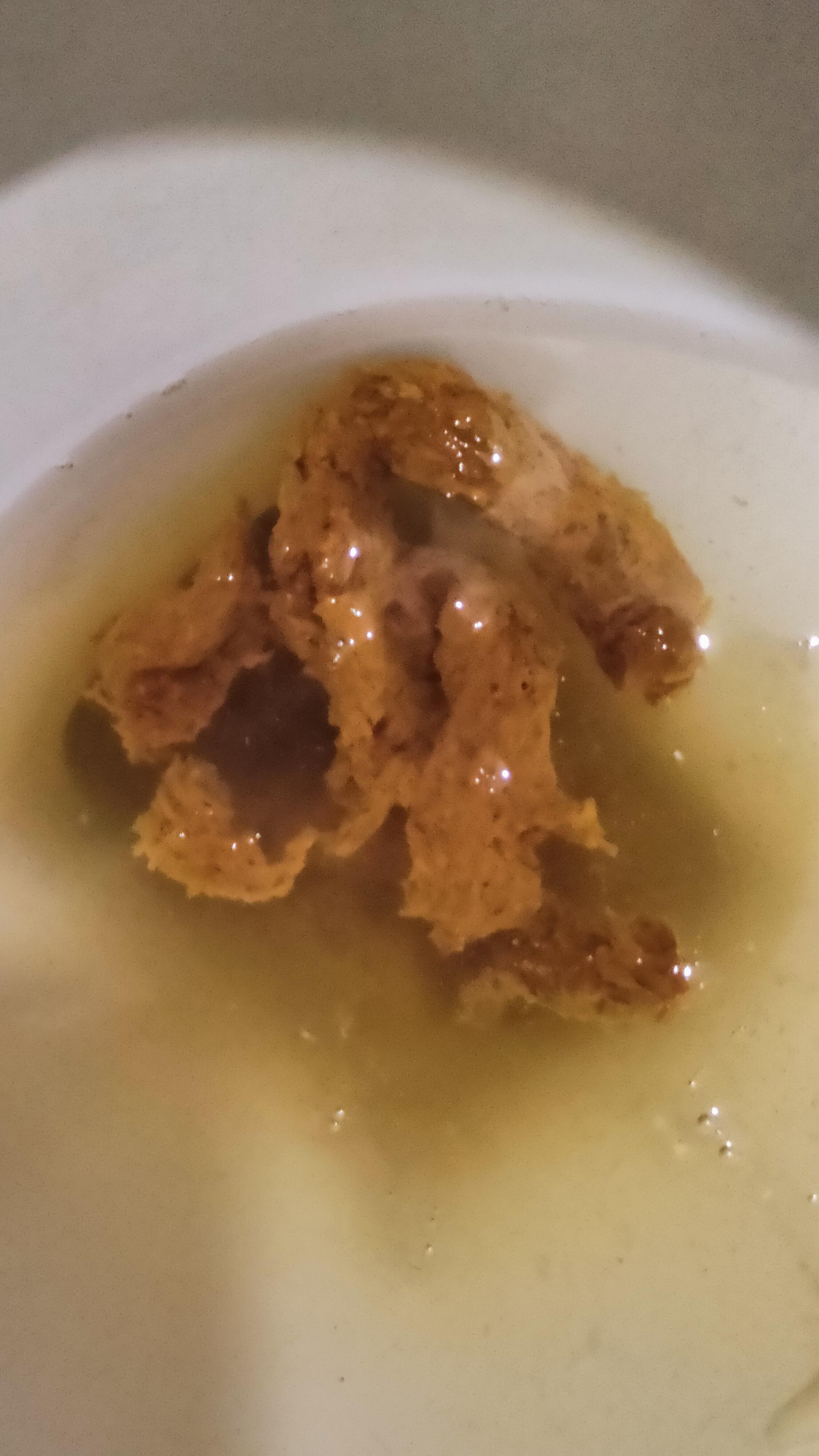 Health Anxiety my poop is like this for the the fast few days sometimes
