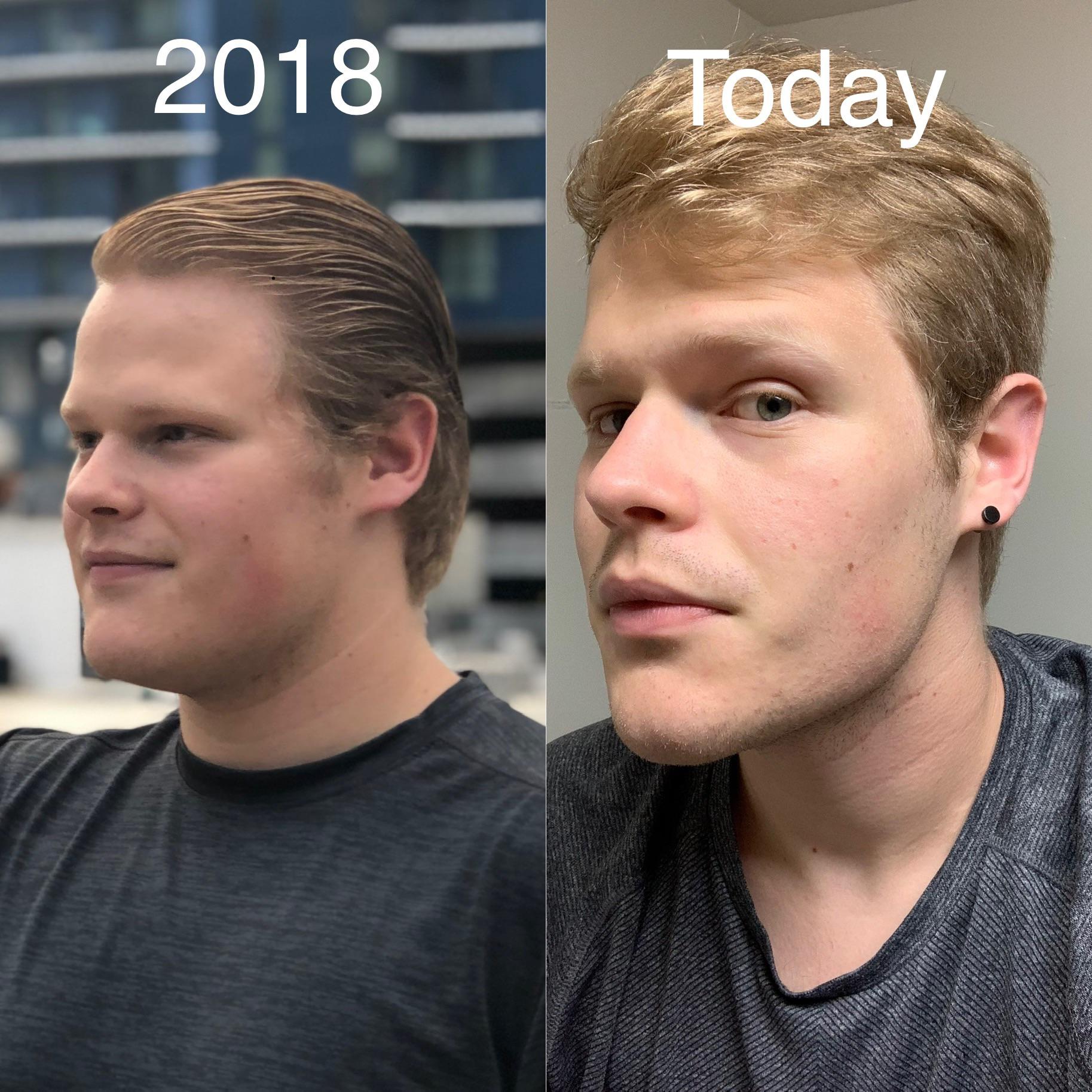 I was looking back at old photos and it’s crazy how much my face