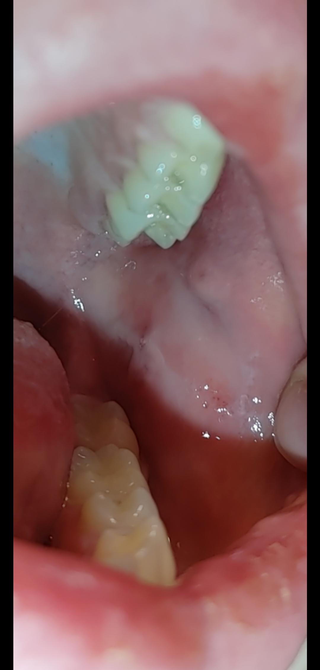 i first noticed the pain in my mouth a few weeks ago, and just now