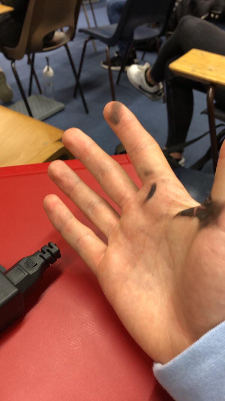 My laptop charger blew up in my hand r/Wellthatsucks