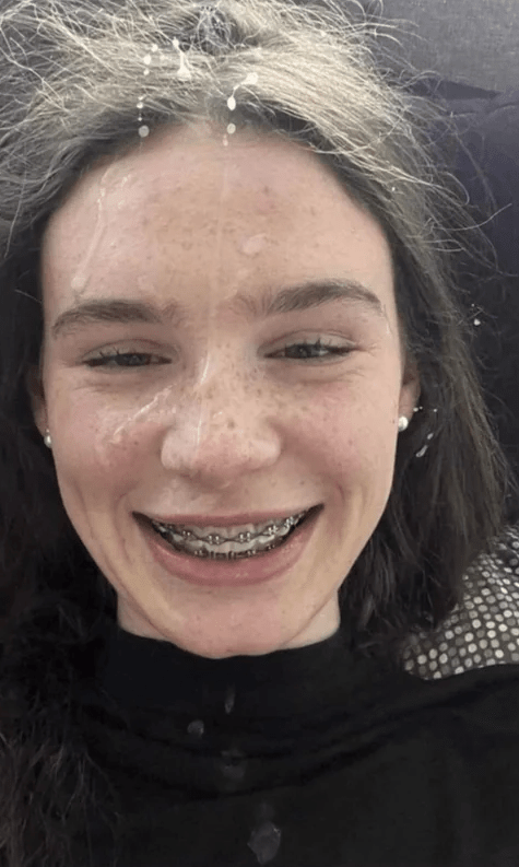 The Braces Need A Load Or Two : Amature_Braces