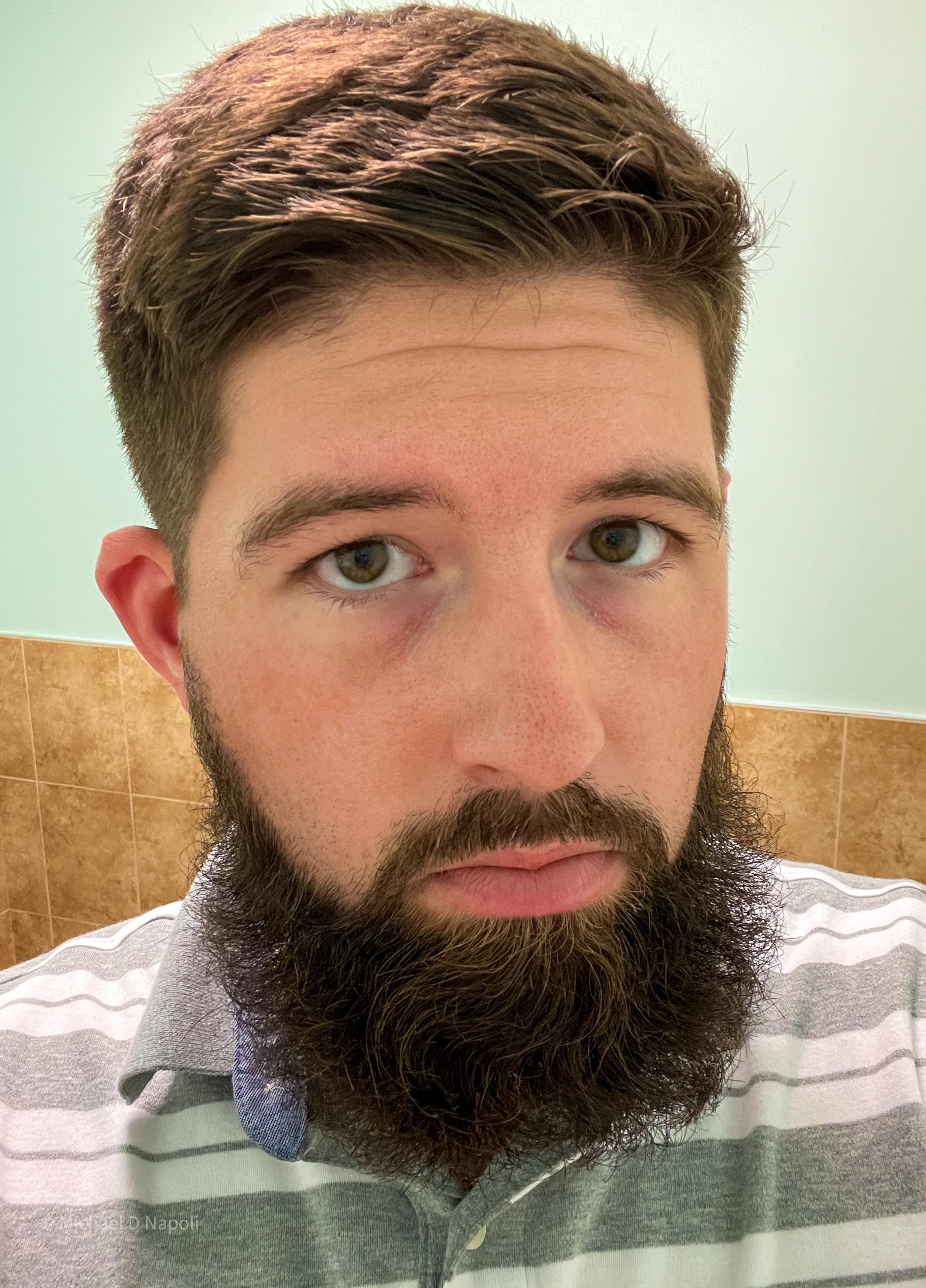 Looking to neaten my beard up a bit. Any Does anyone