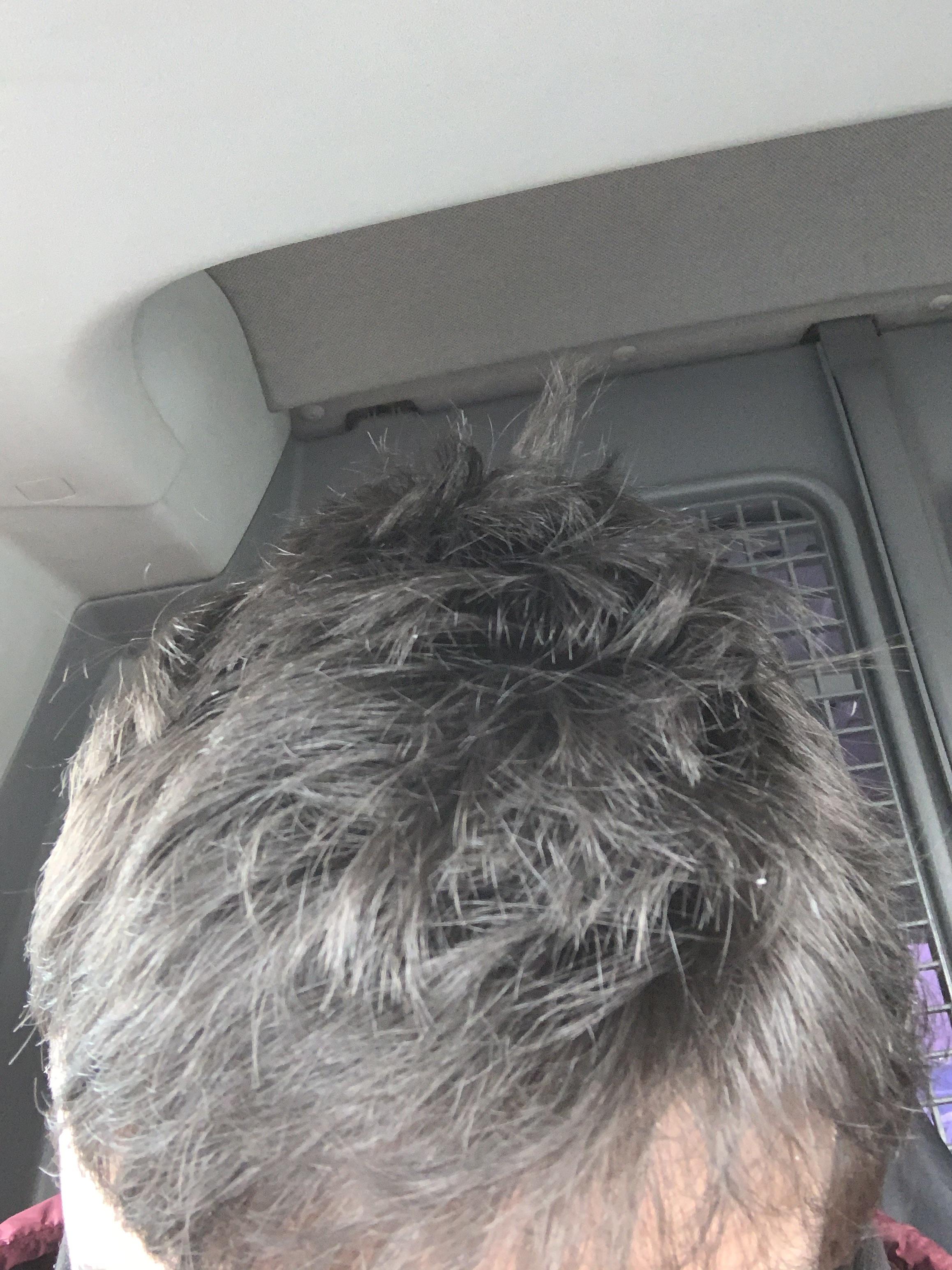 I’ve literally tried H&s shampoo and some anti dandruff one but I’m