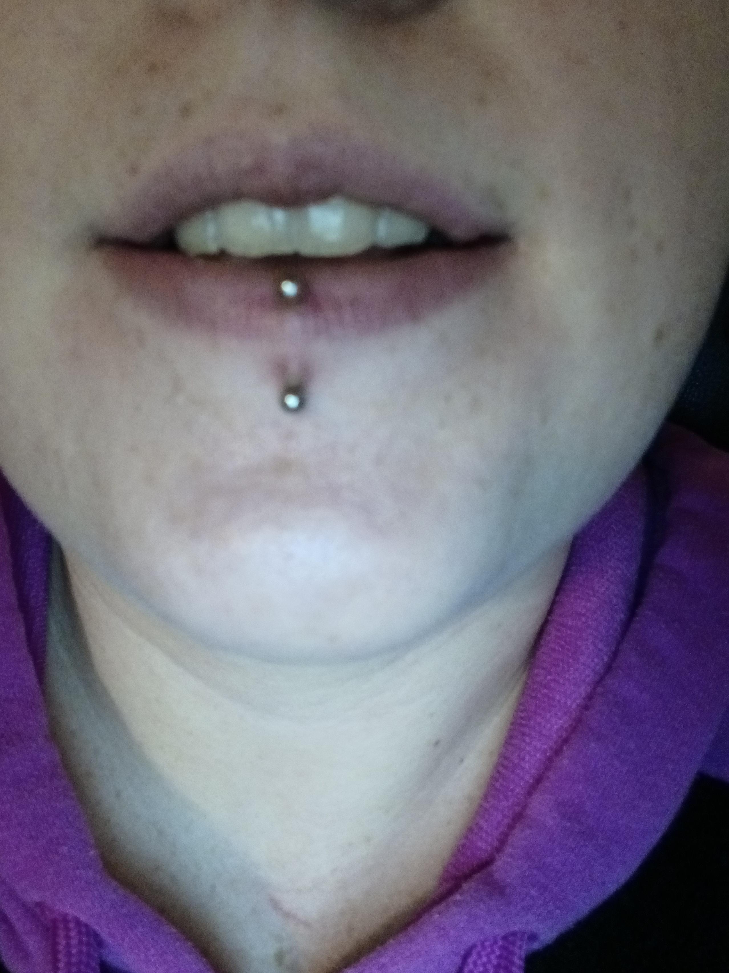Vertical Labret Rejection