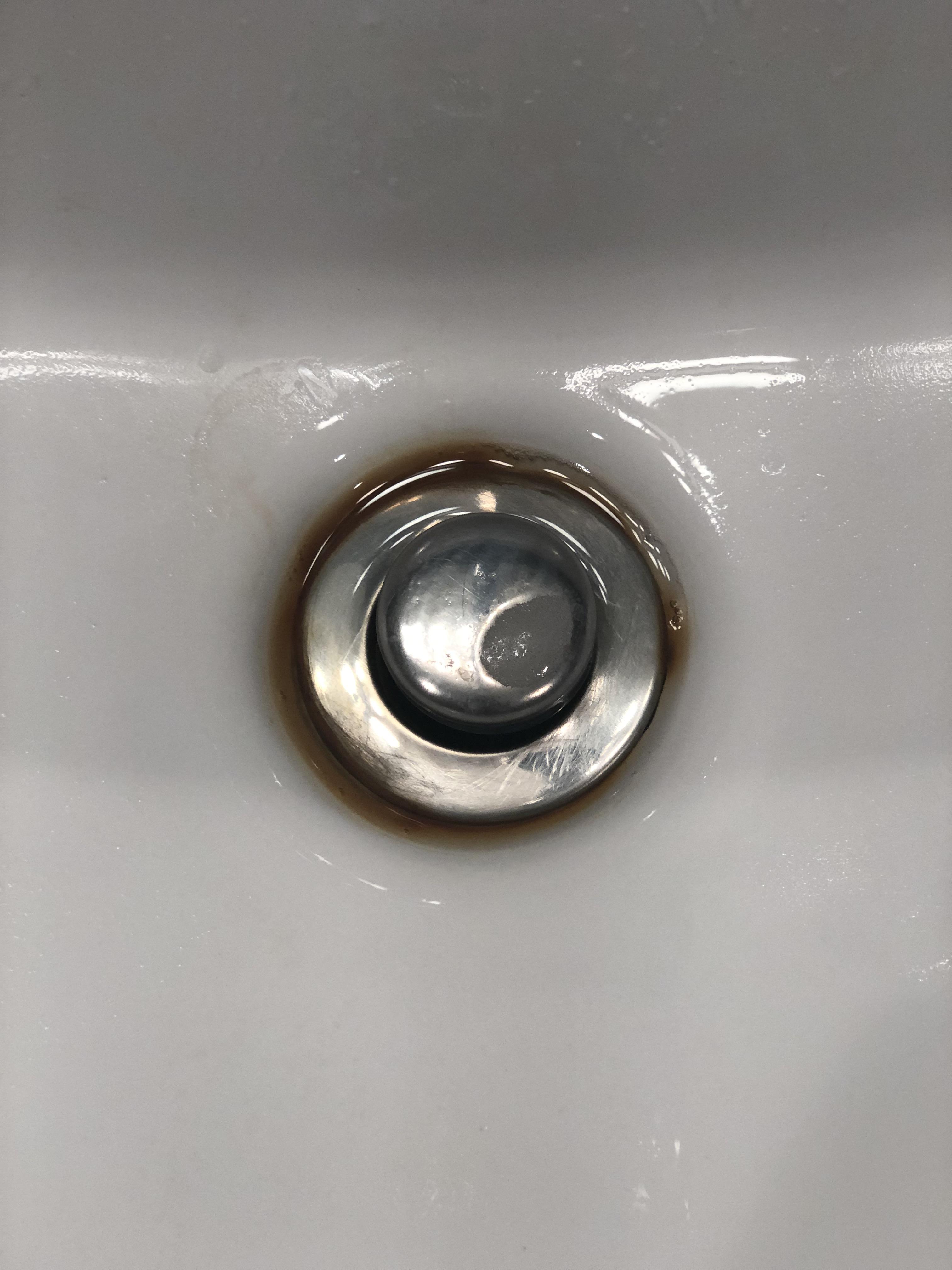 Can anyone tell me what this brown ring of whatever is, that keeps