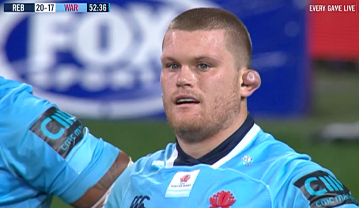 Tom Robertson's ear r/rugbyunion
