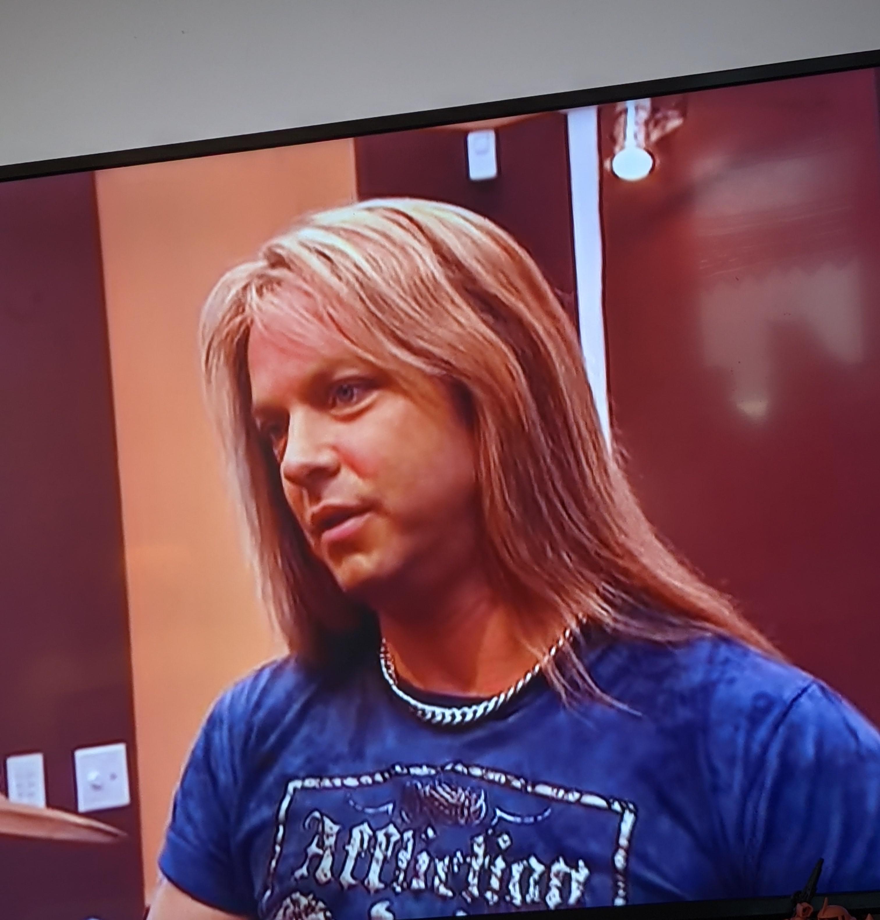 Bret Michaels Without Hair Bret Michaels Hospitalized With Undisclosed