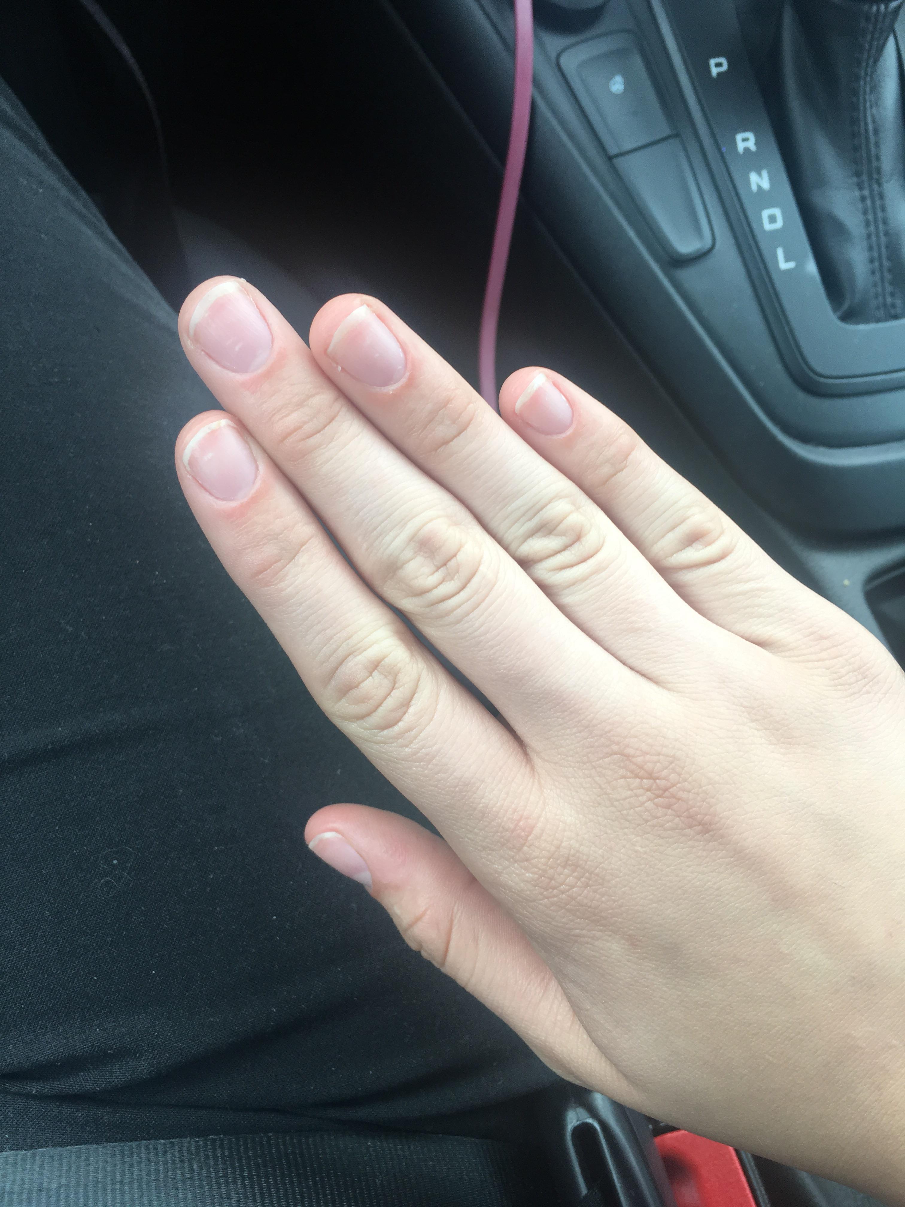 After biting my nails for upward of 15 years, I can finally see the