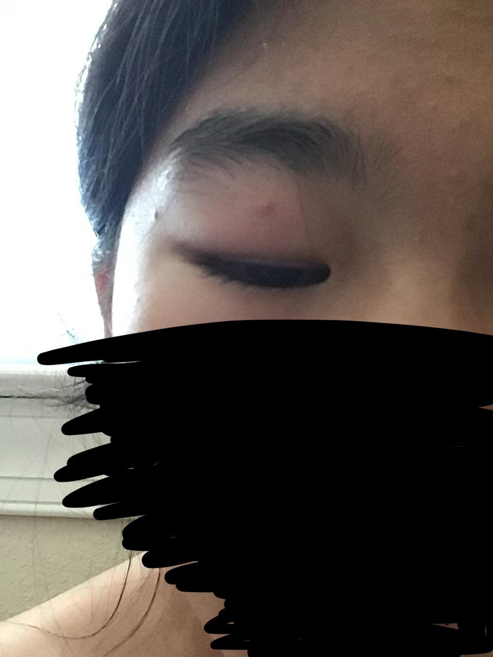 what is this bump on my eyelid and how do i get rid of it? ive had it for a while but now it