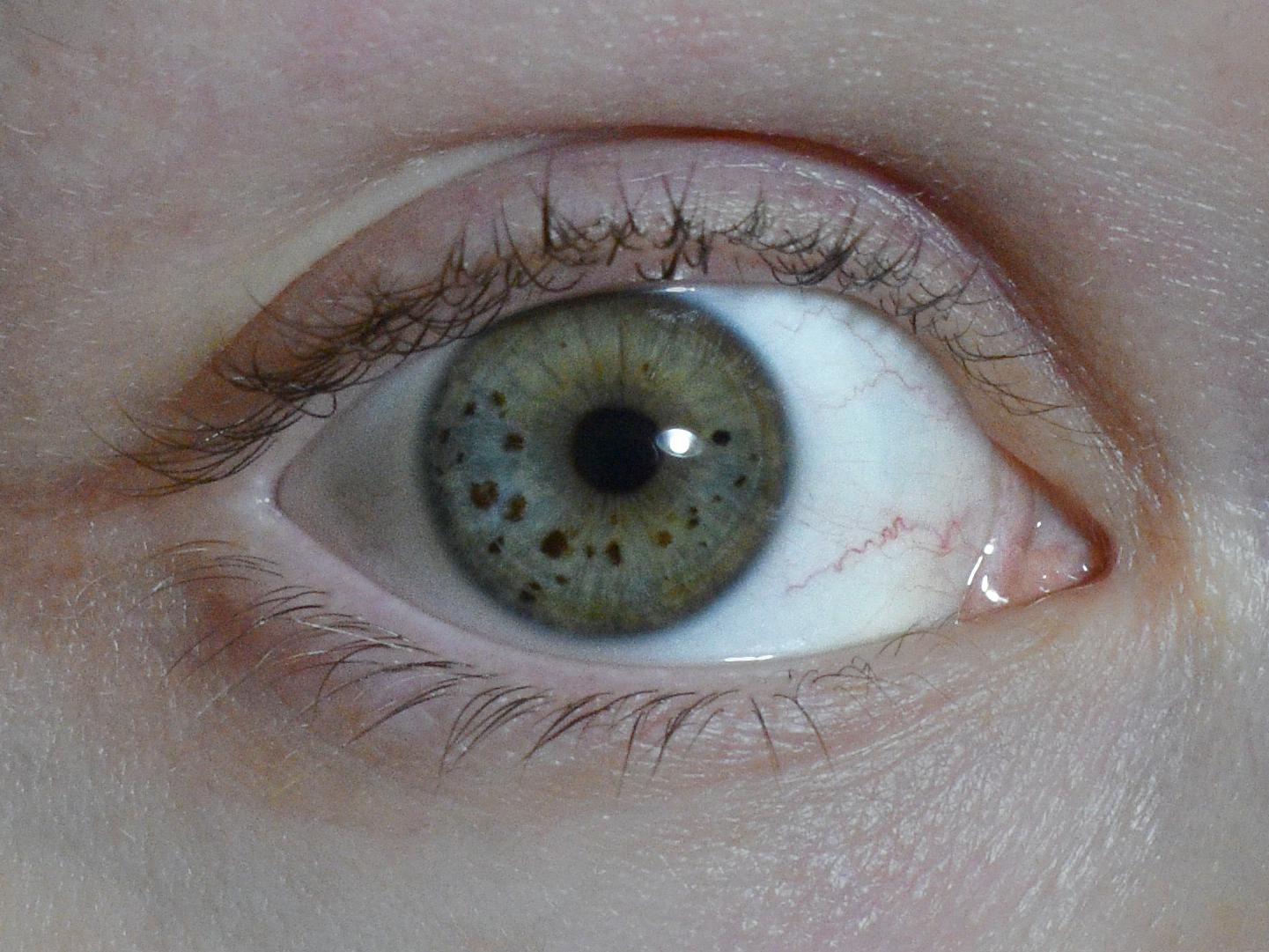 My eye has pigment speckles in it. r/mildlyinteresting