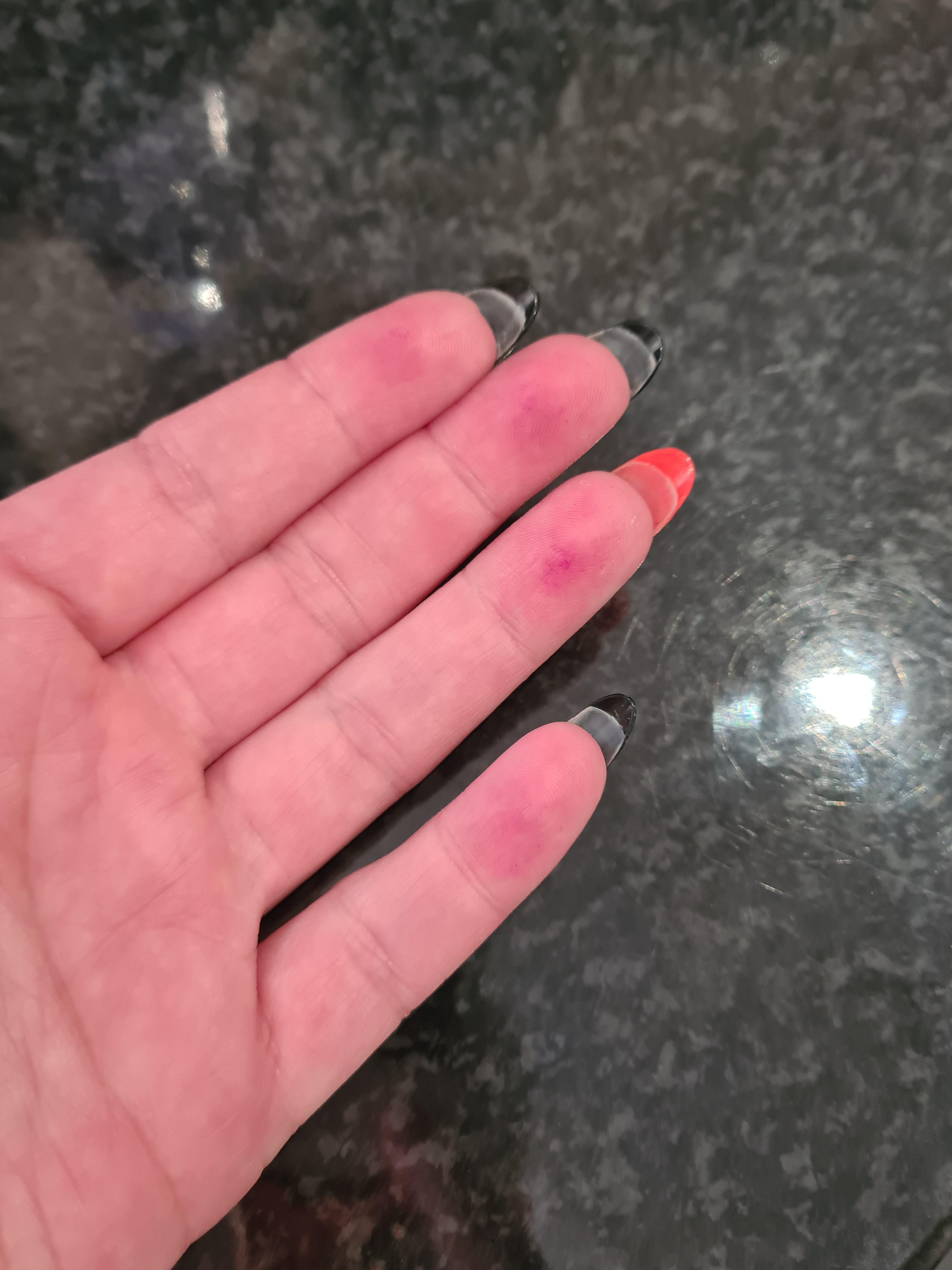 So... is friction burn on your fingertips a thing? Didn't realise I'd
