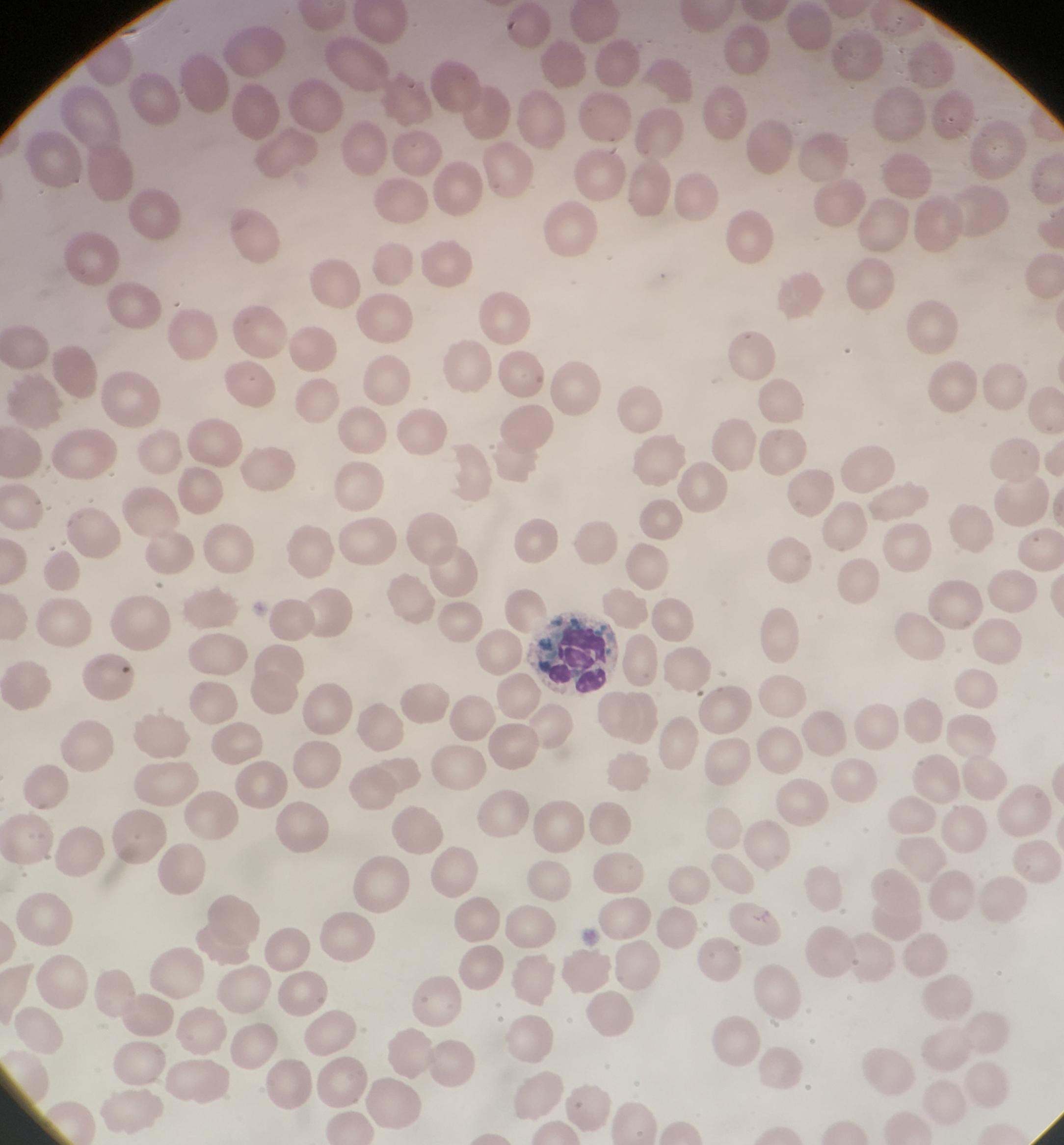 Day 10 training as an new MLS and I found some "green crystals of death