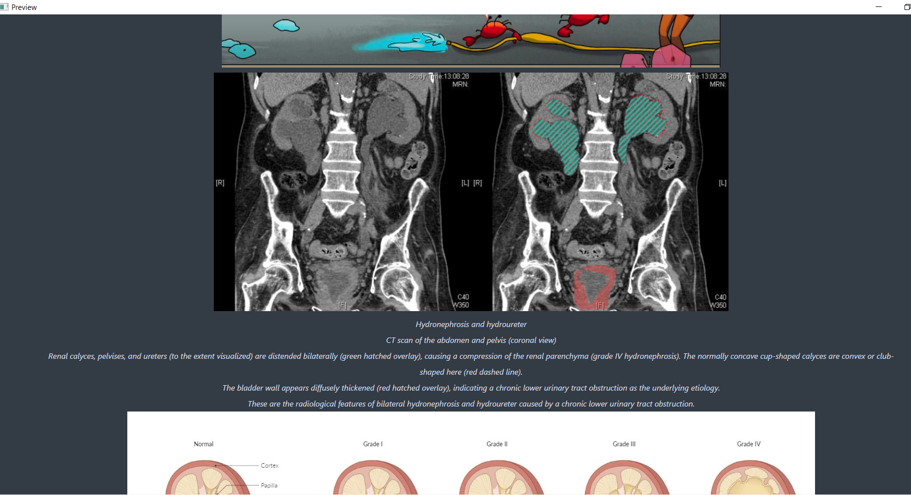 Anki deck for family medicine shelf, please