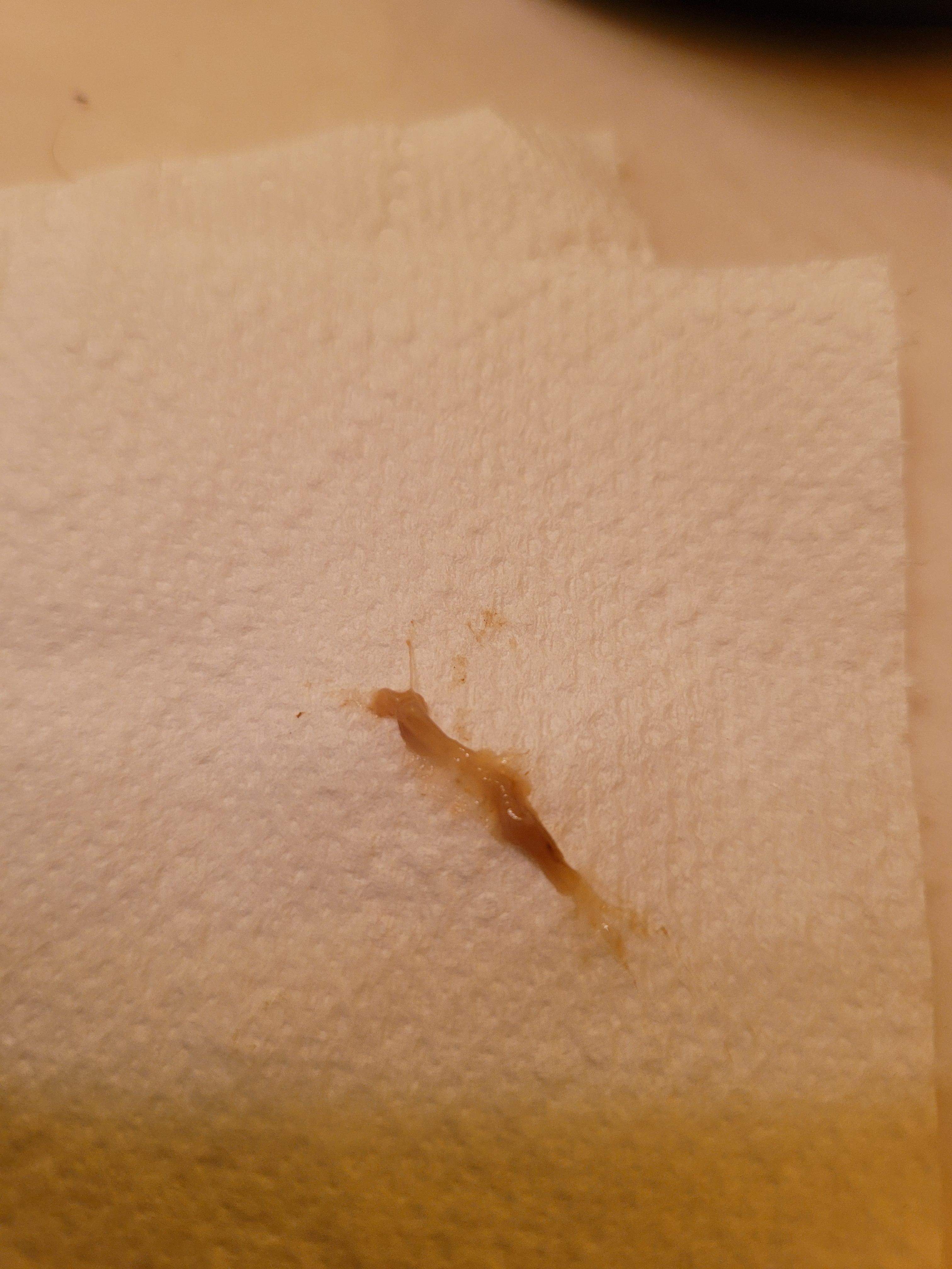 After just peeing, wiped this off my anus. Dr. said I have pinworms