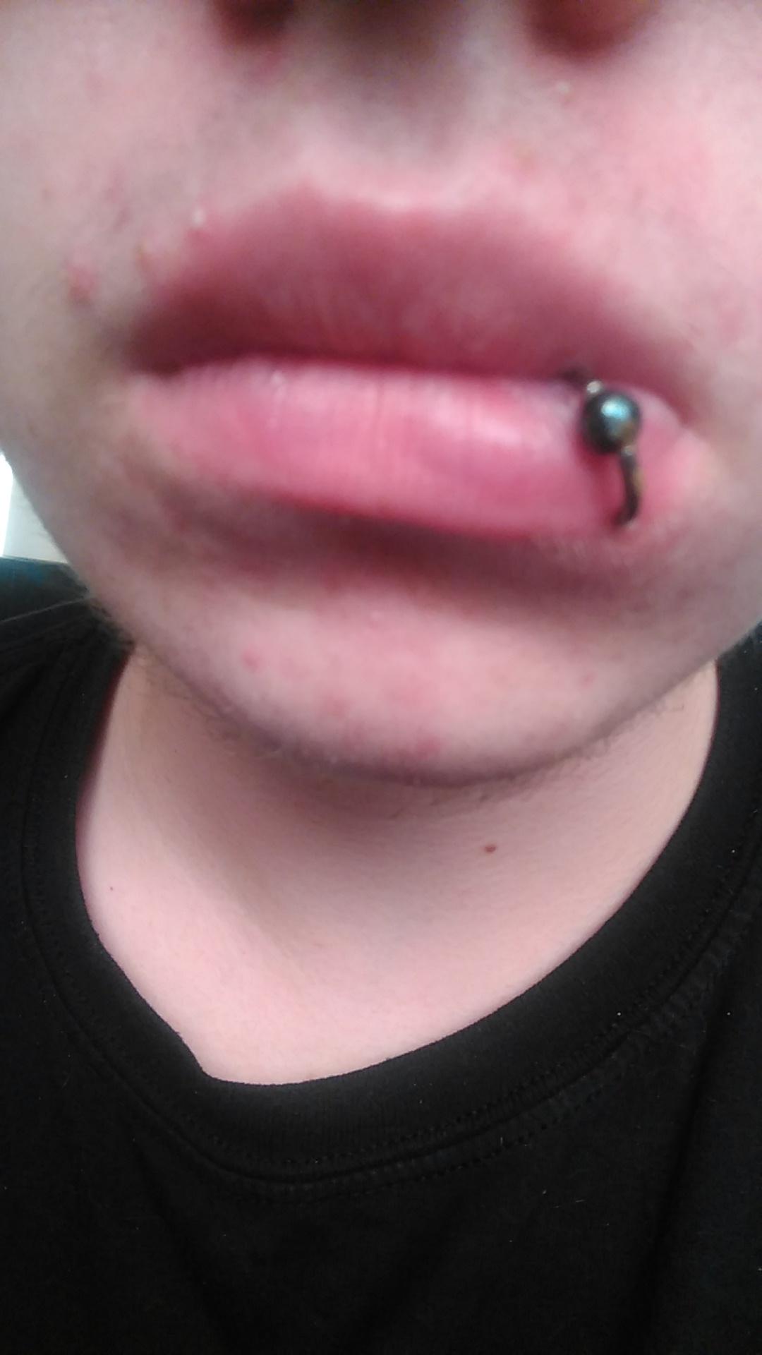 Got my lip pierced in January, and my lip droops now, anyone know how i