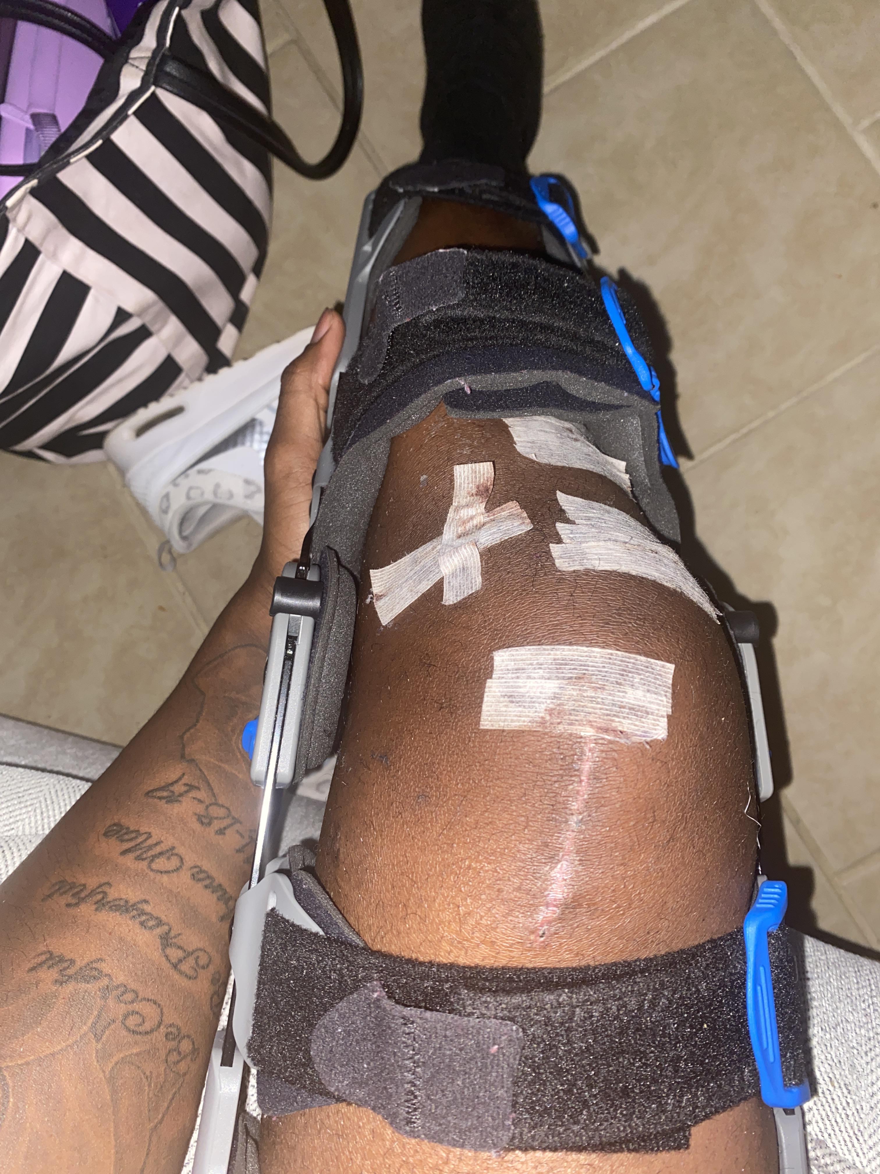 Quadriceps Tendonitis Brace