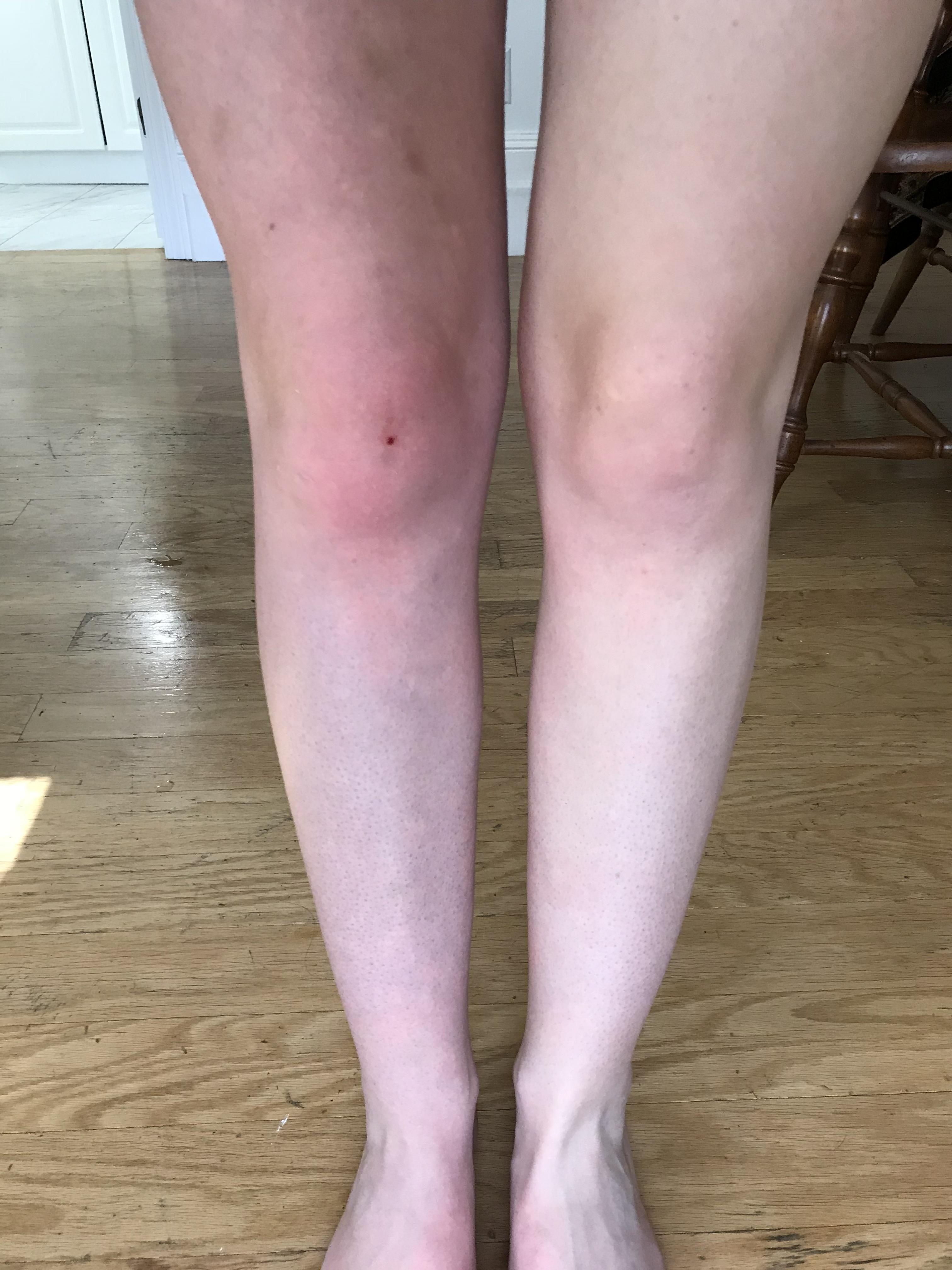 My legs before and after using lotion. r/mildlyinteresting