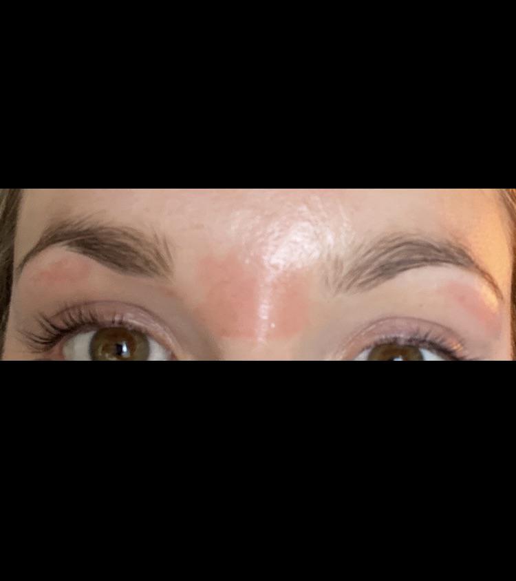 I had my eyebrows waxed yesterday and the red patches feel burnt? Has