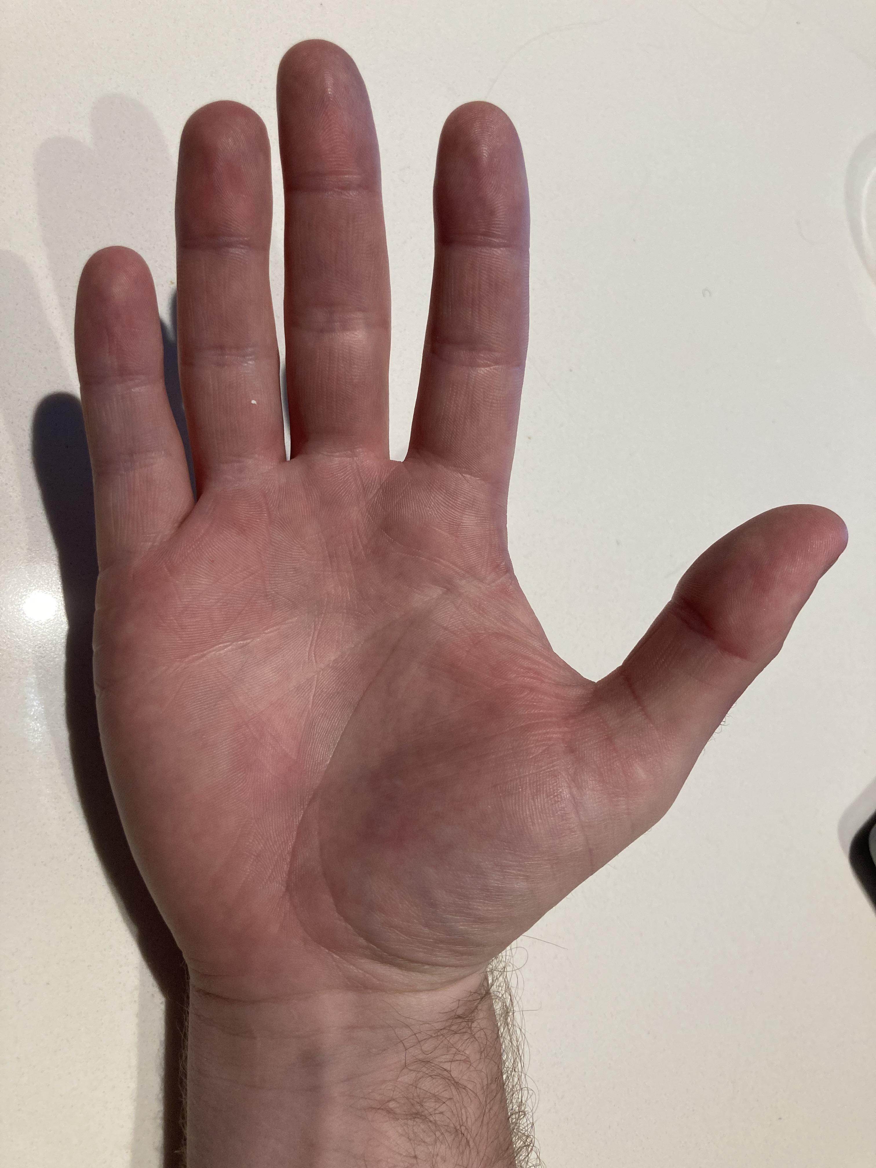 Mole on right hand meaning catholiclasopa