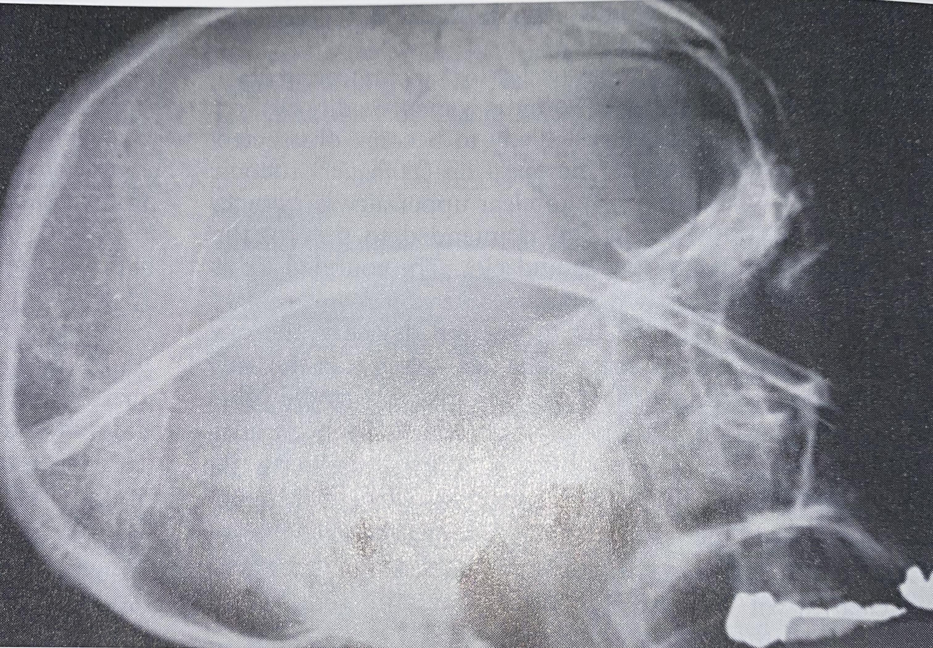 What happens if you drink water within 3 hours of a ct scan with