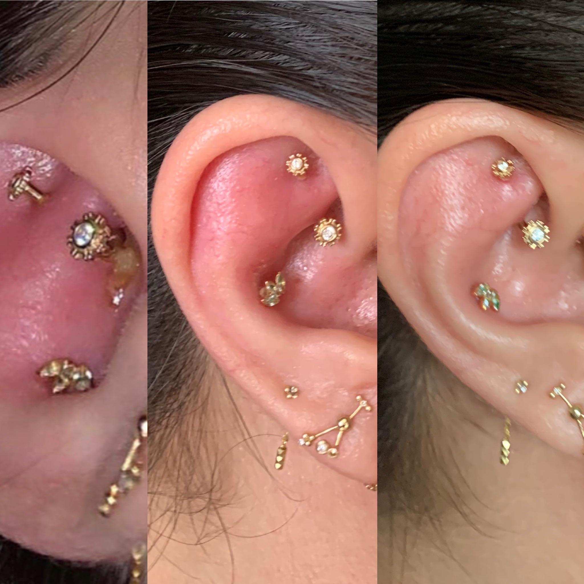 Update rook swelling and redness improved after antibiotics. Thanks