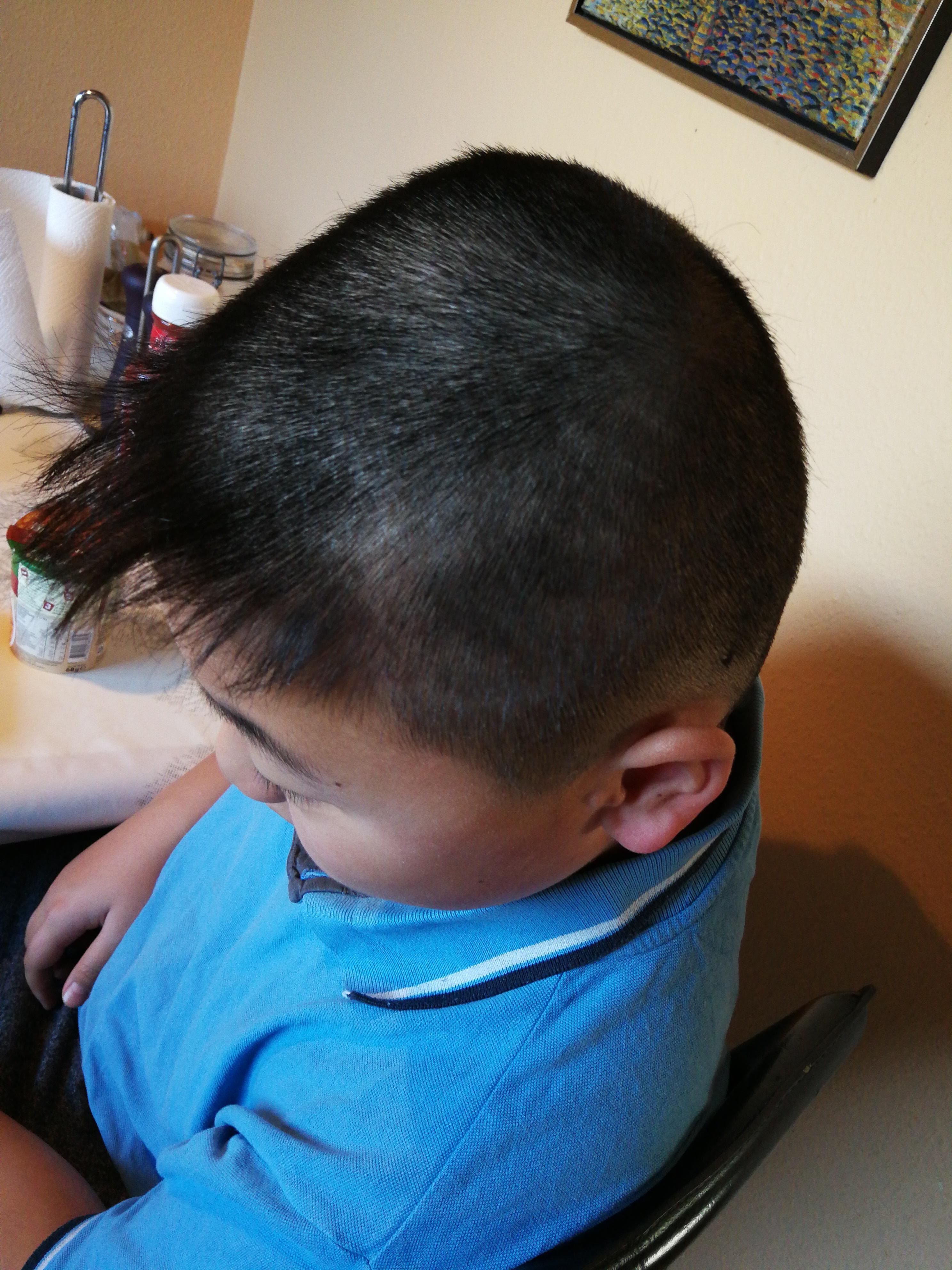 Brothers haircut from lawnmower. r/Justfuckmyshitup