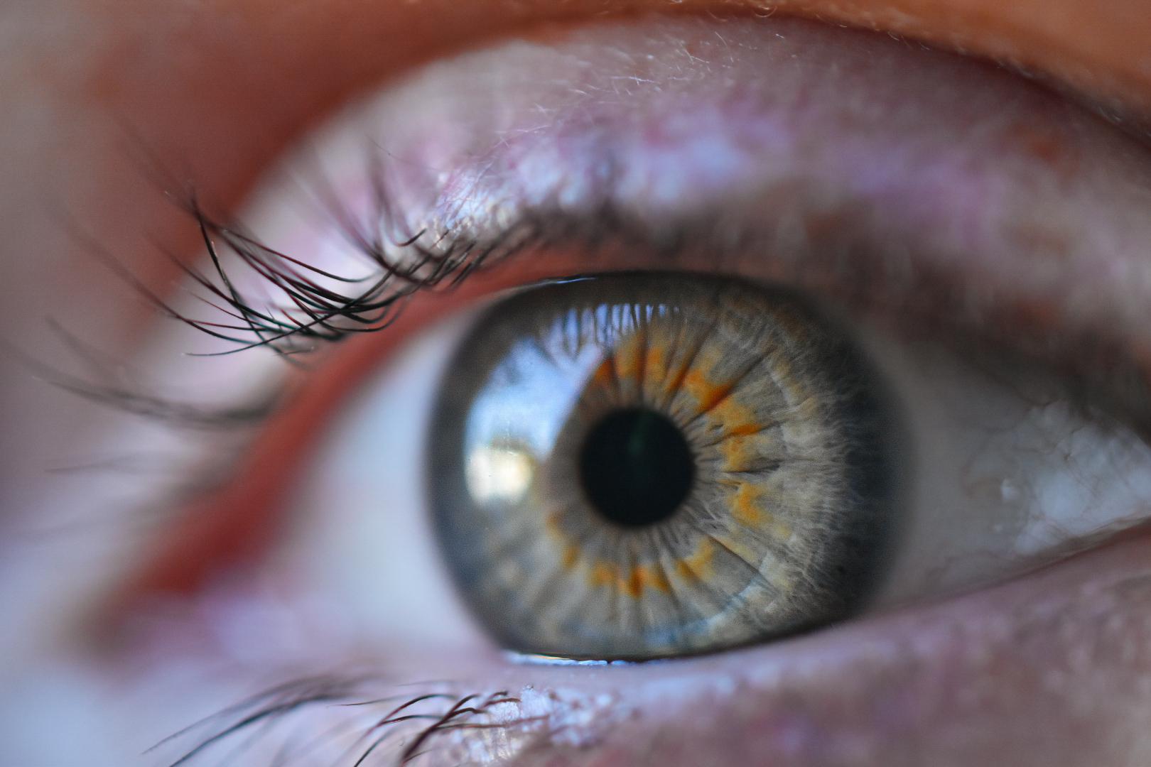 My irises have an orange ring in them r/mildlyinteresting