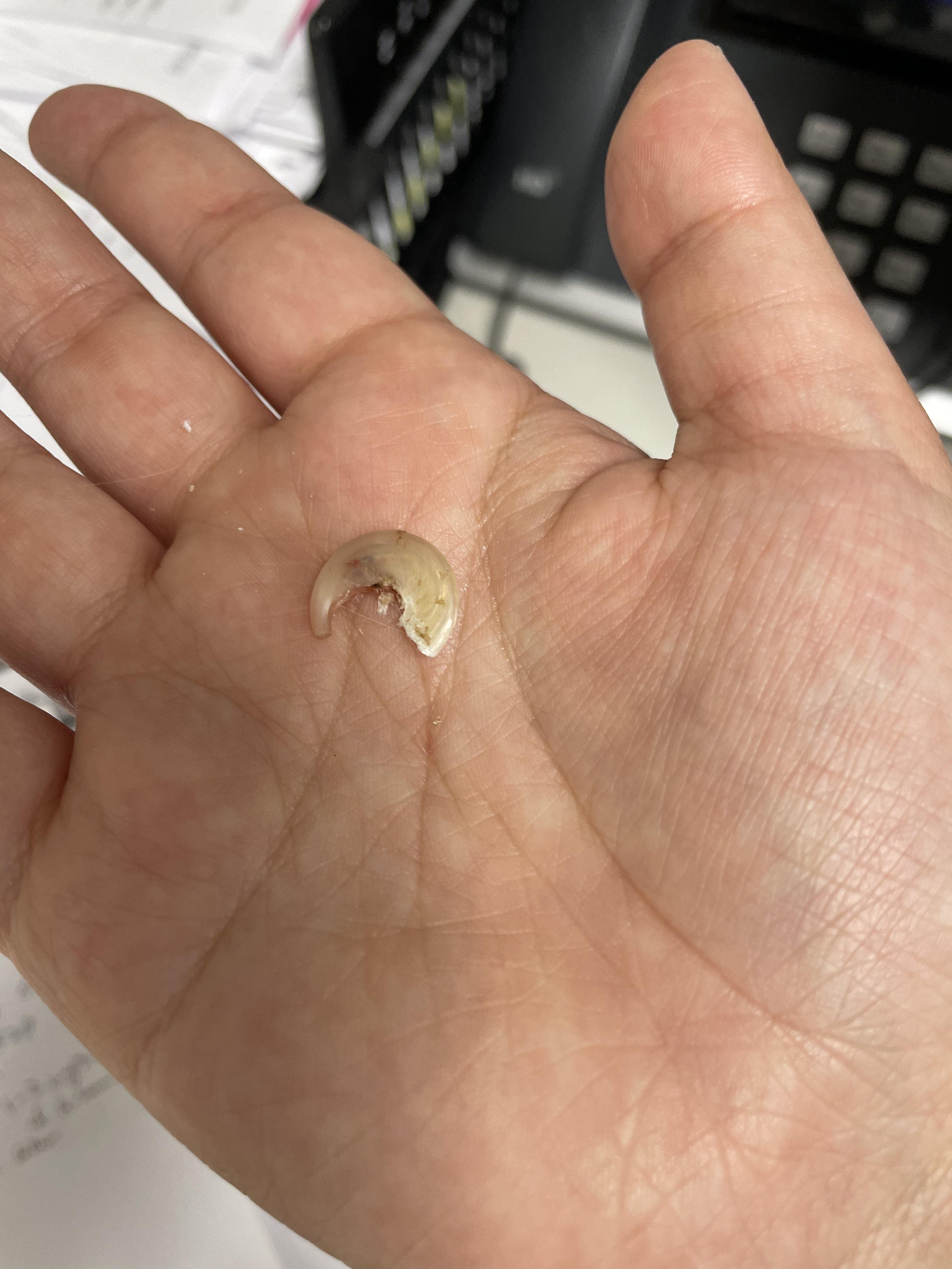 Another embedded kitty claw! The entire darker tip was curled back into