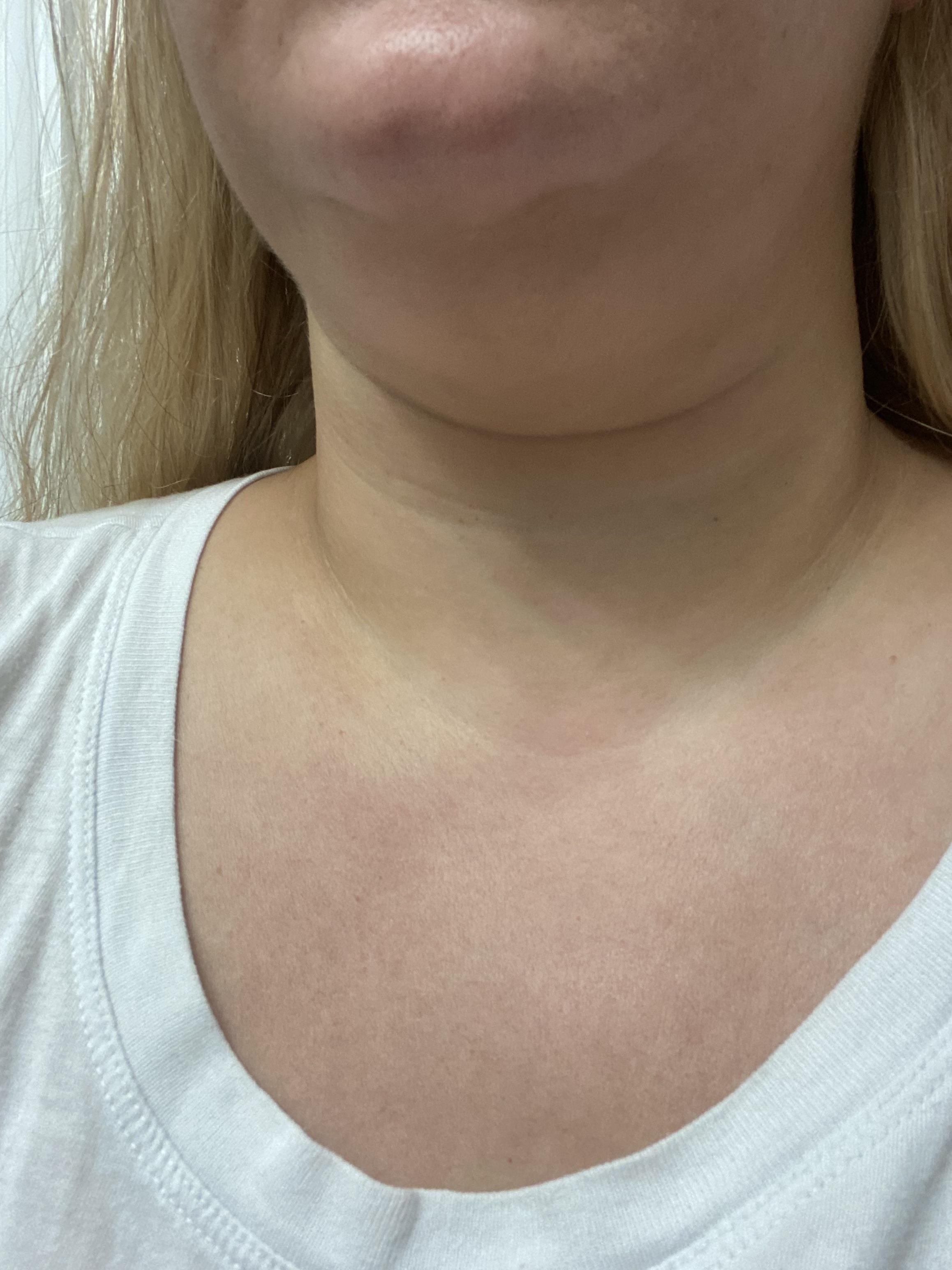 Suggestions for Neck Folds? info in comments r/SkincareAddicts