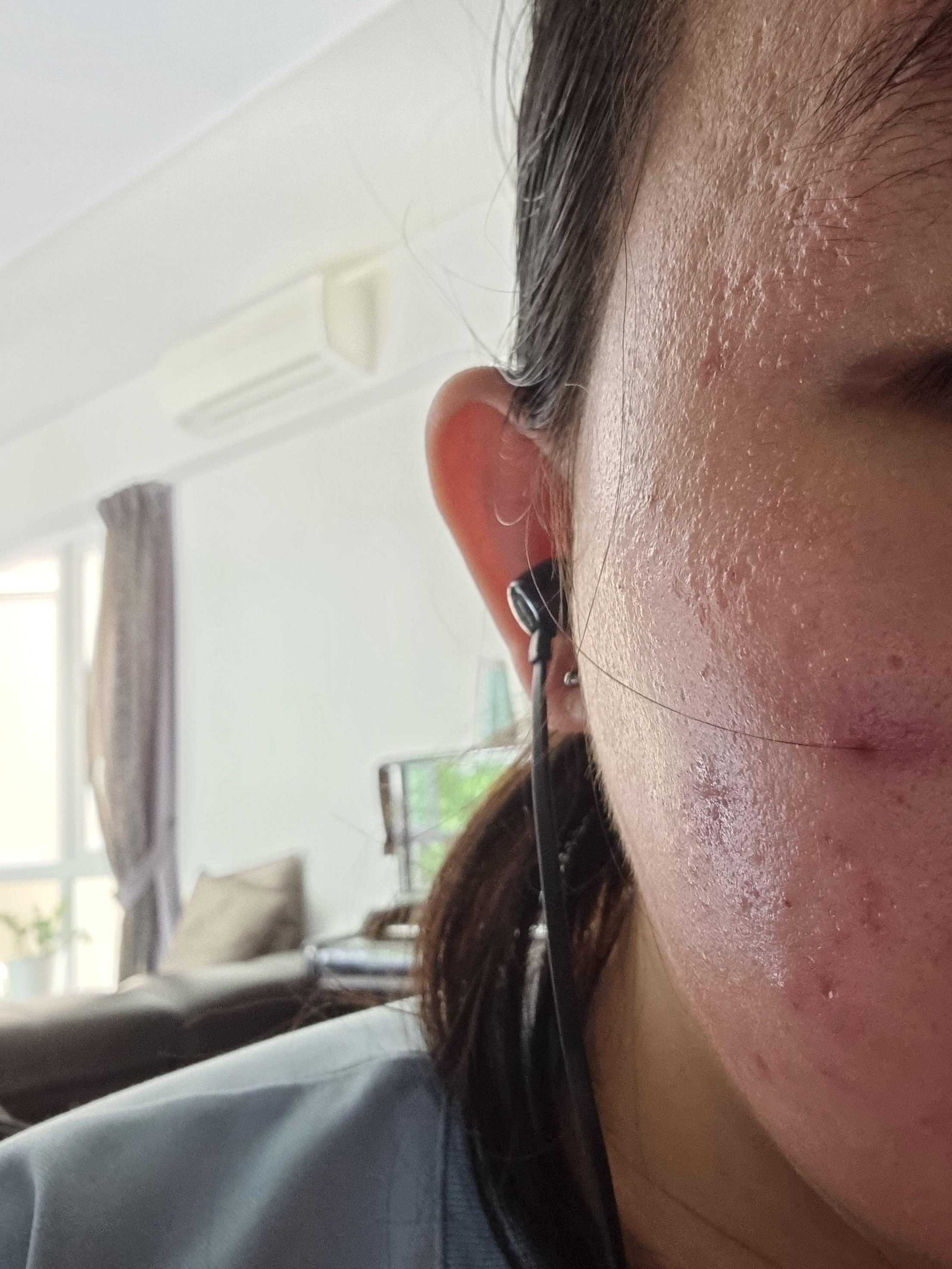 Sudden Bumps on my left cheek what do i do? ( r/acne