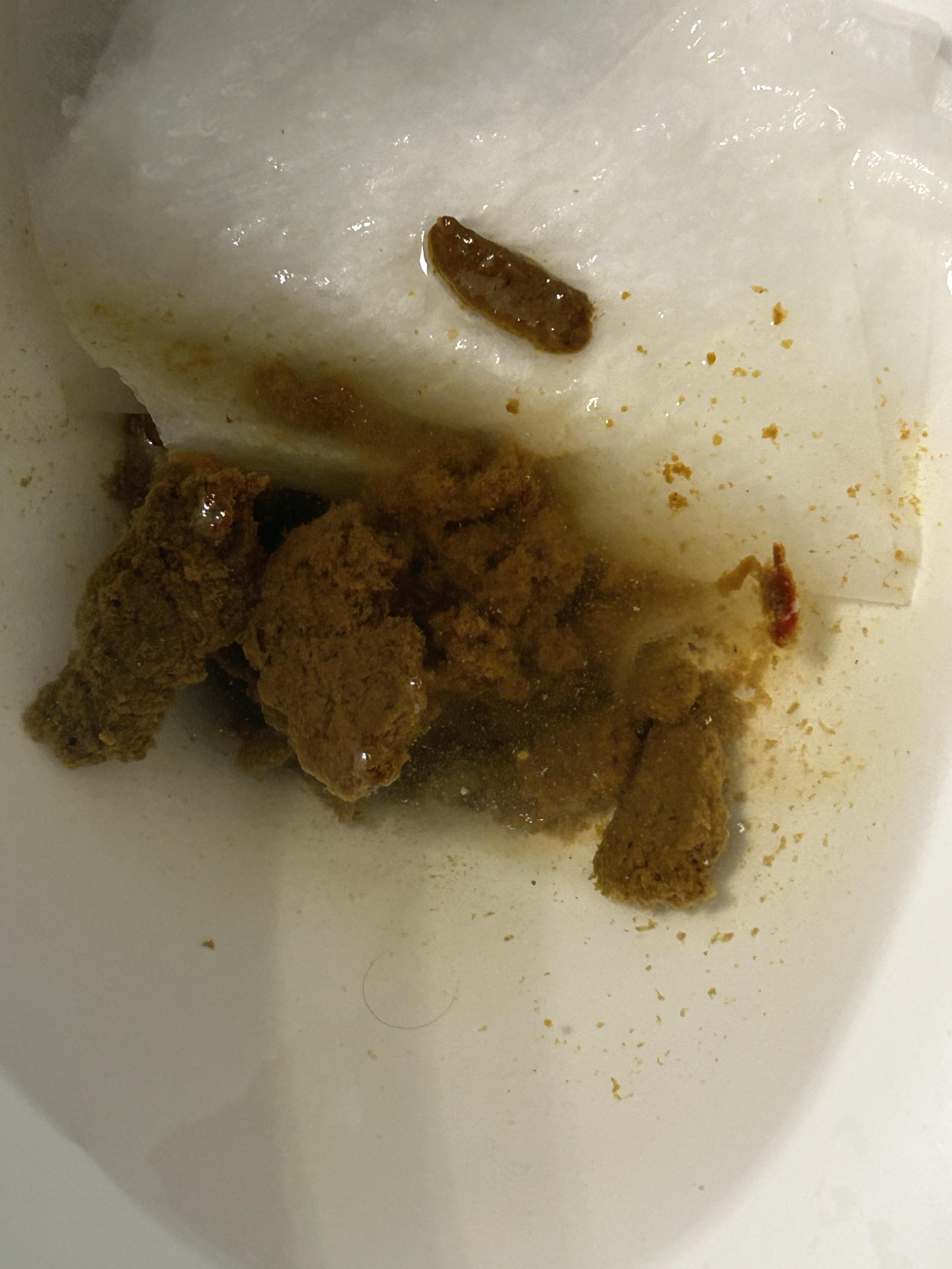 Blood? r/poop